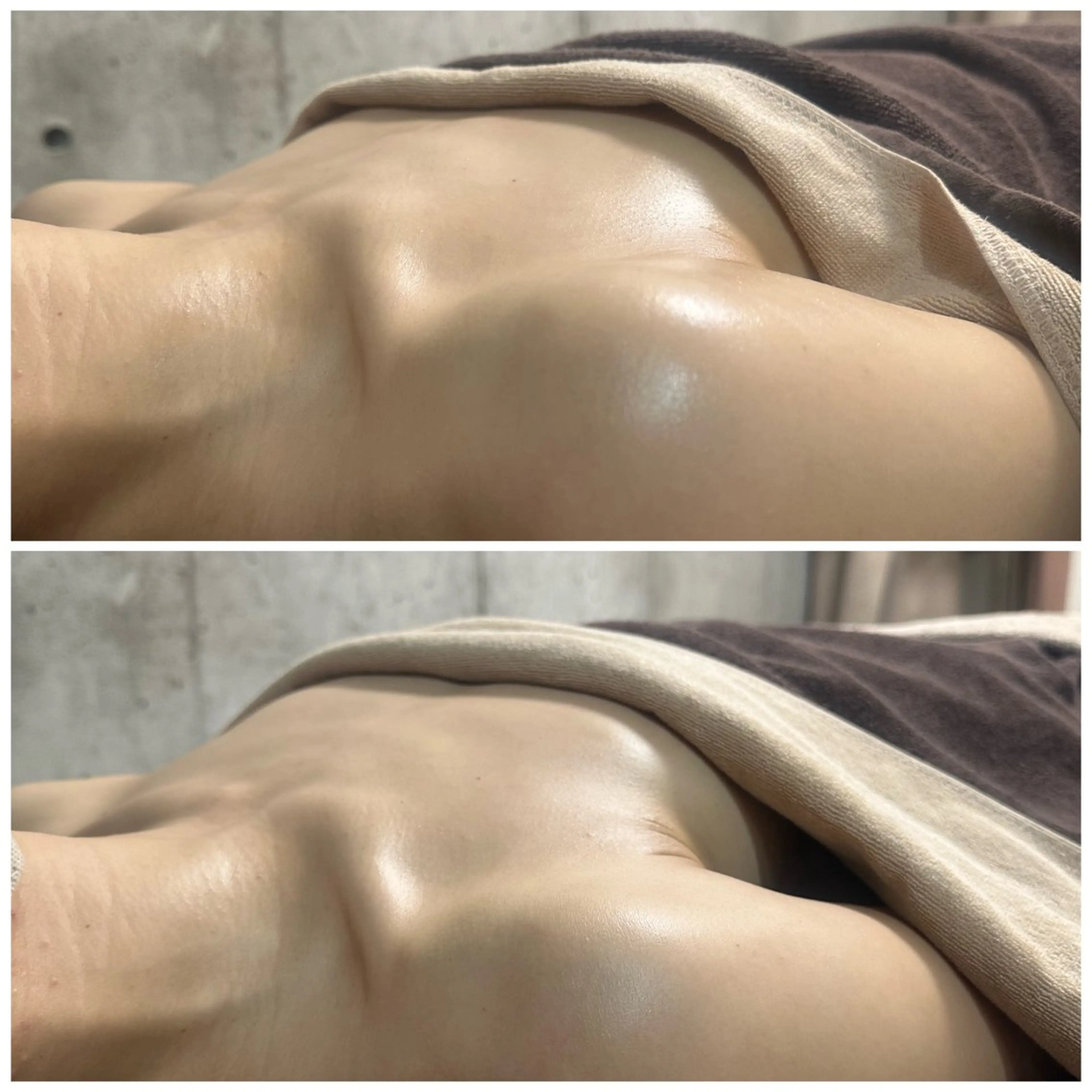 脱肩首こり💥巻型改善！全身リンパトリートメント＋バストアップ(80分)の写真