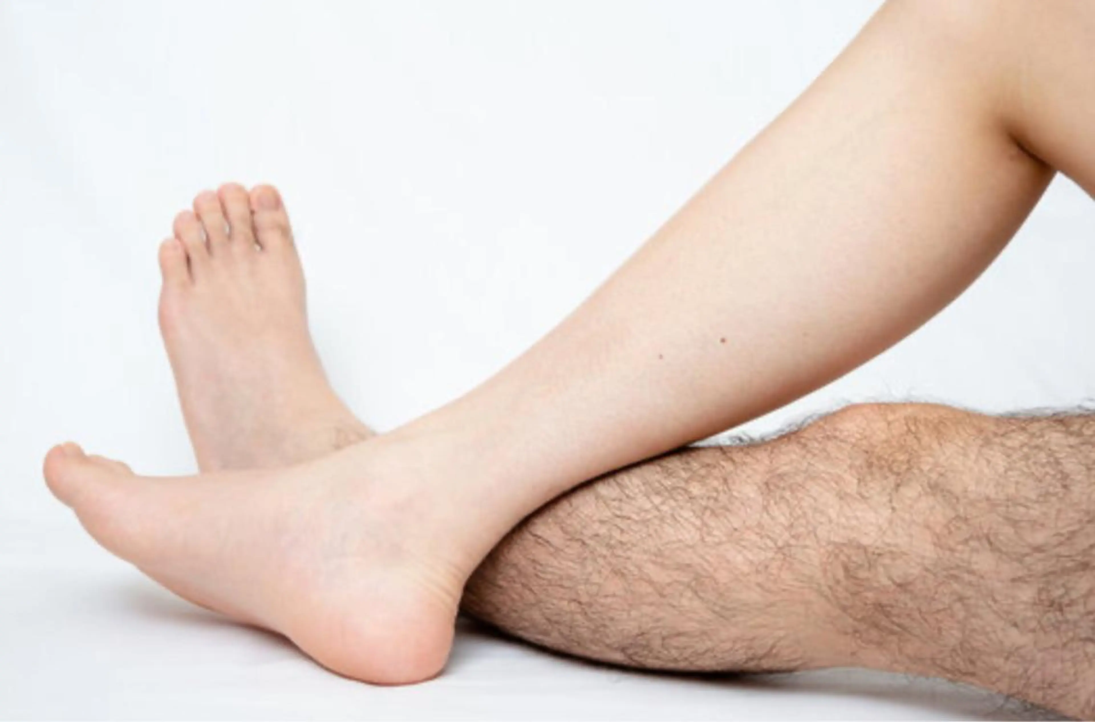 【両脚脱毛　メンズ脱毛】の写真