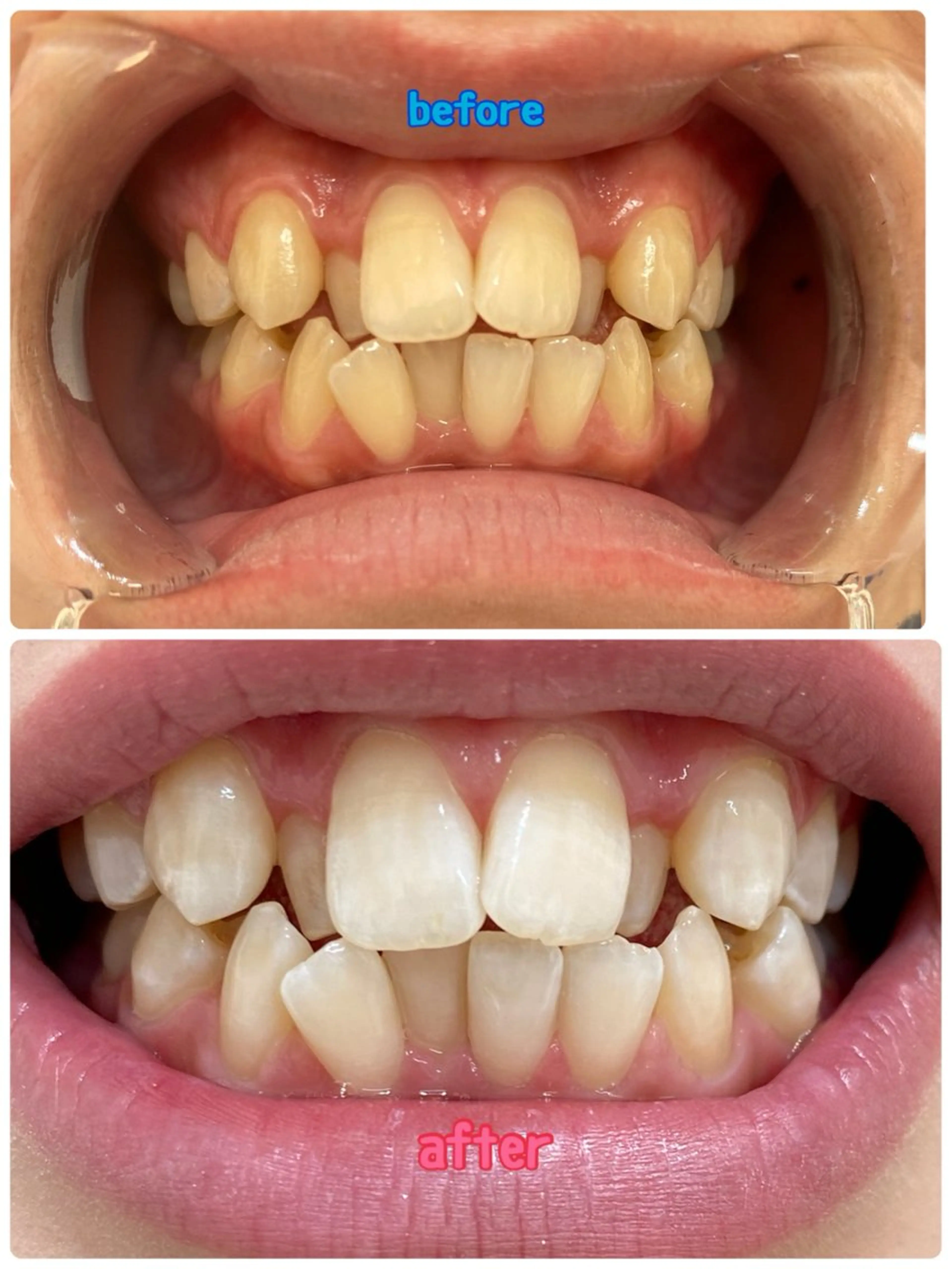 エステ 長谷川 玲美のエステ・リラクイメージ