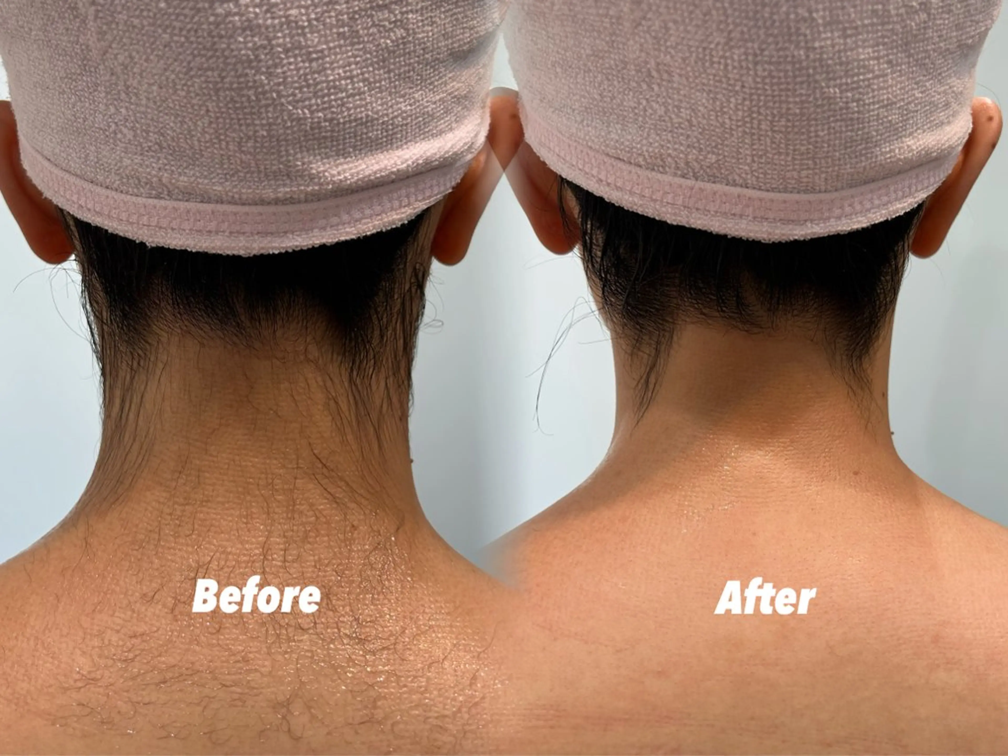 その他 🫧美しい素肌へ🫧 今成柚乃のその他イメージ