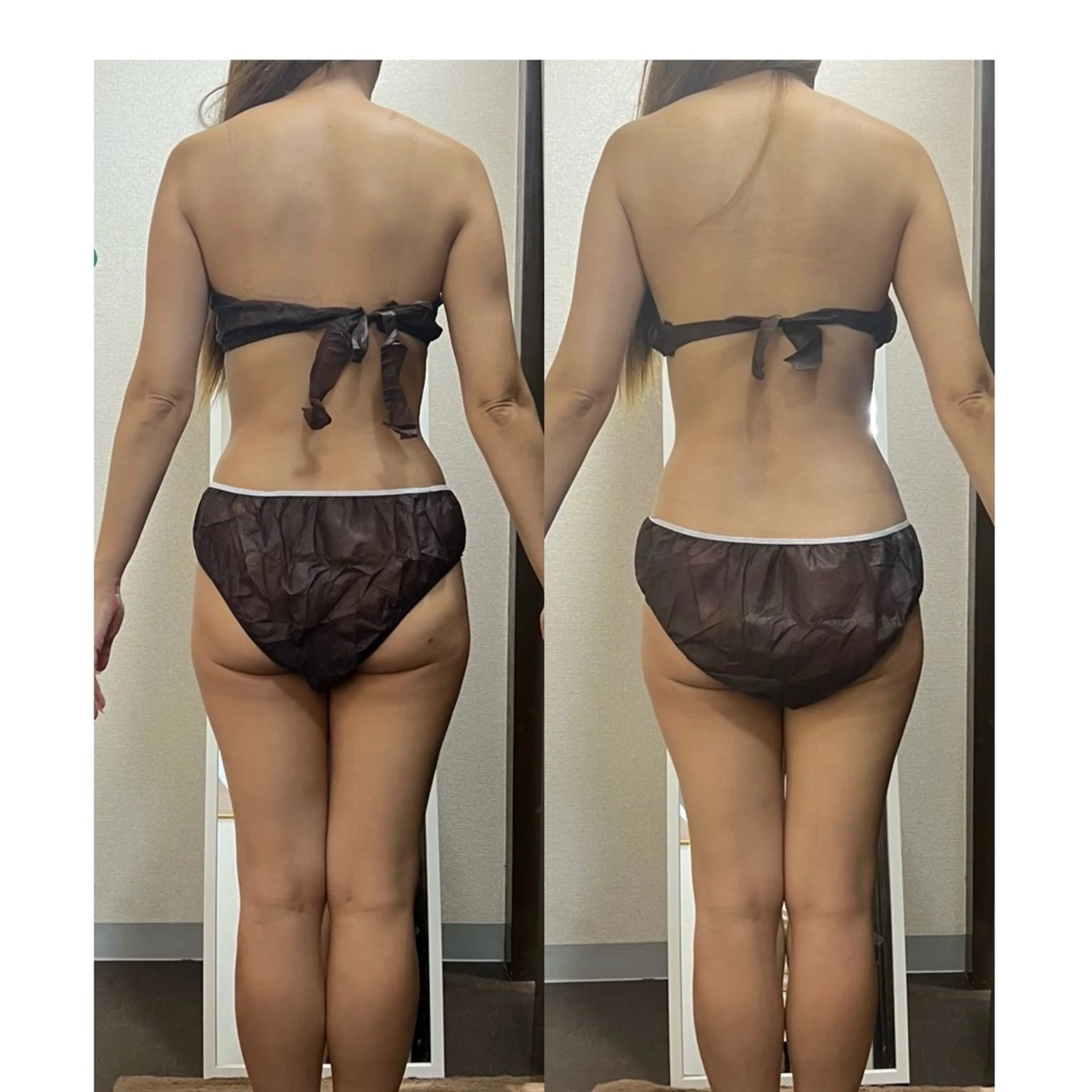 ハイパーナイフ専門店　Salon de COCO所属・Salon de COCOのエステ・リラクイメージ