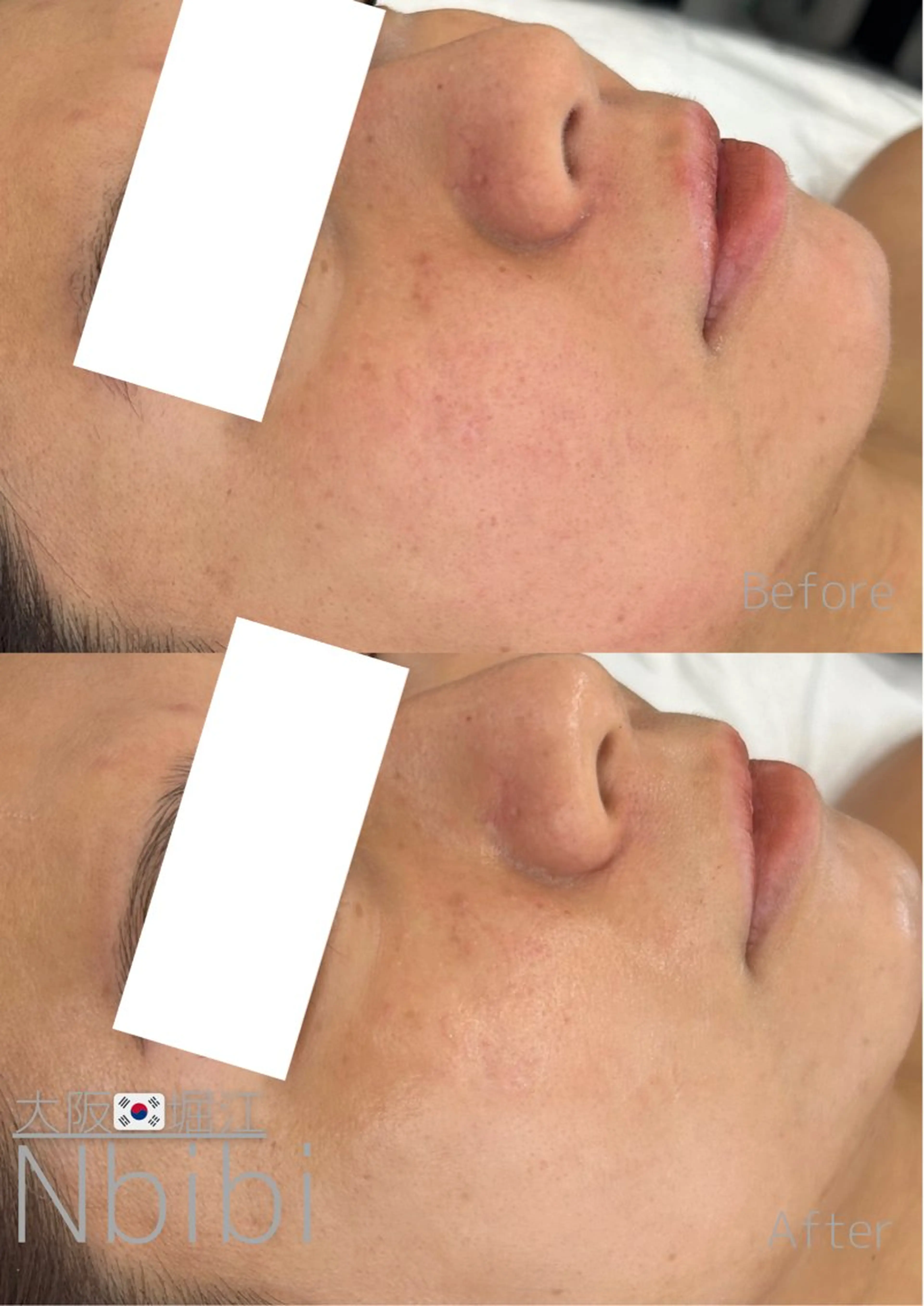 韓国🇰🇷価格 サロン_Nbibiのエステ・リラクイメージ