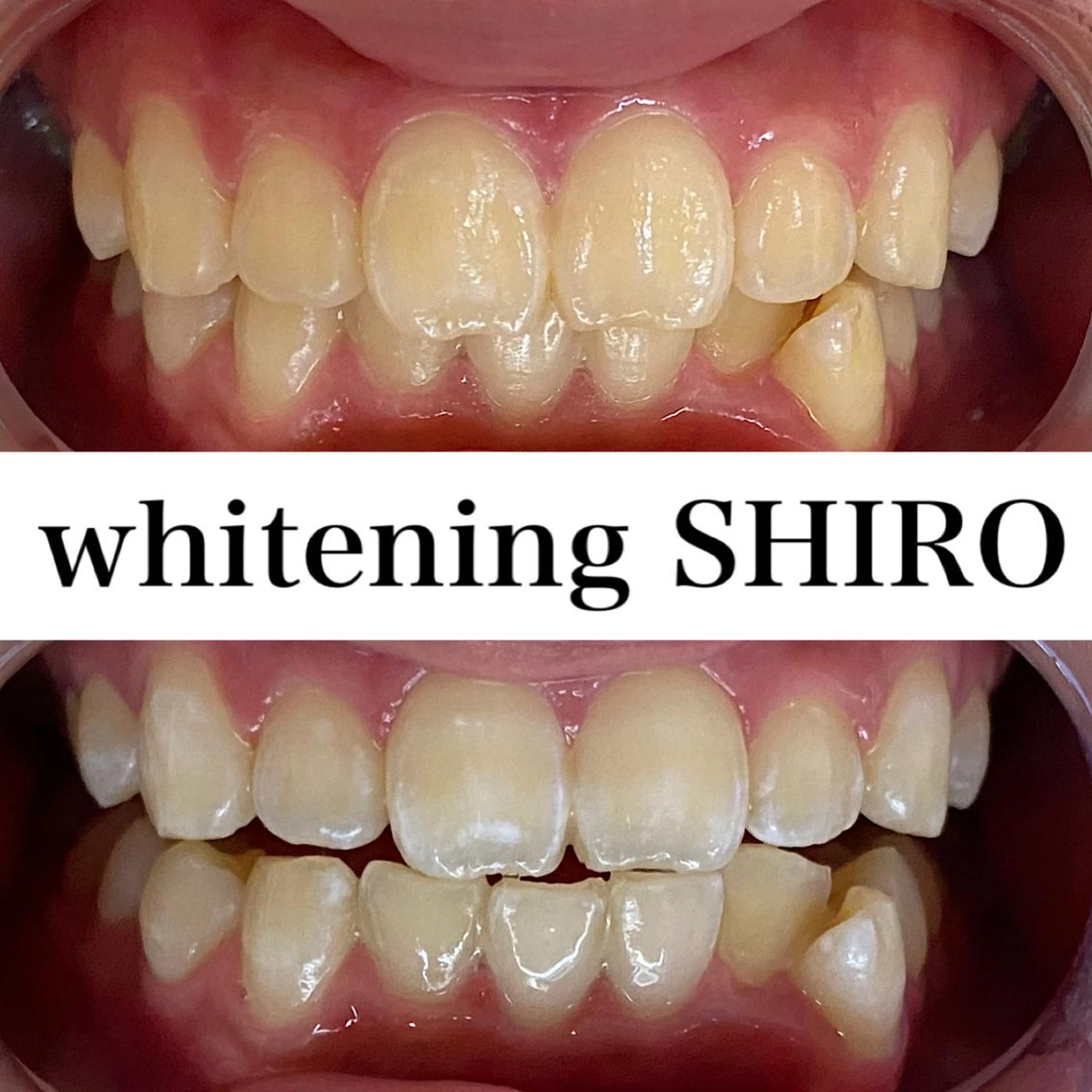 福岡ホワイトニング SHIRO天神店のエステ・リラクイメージ