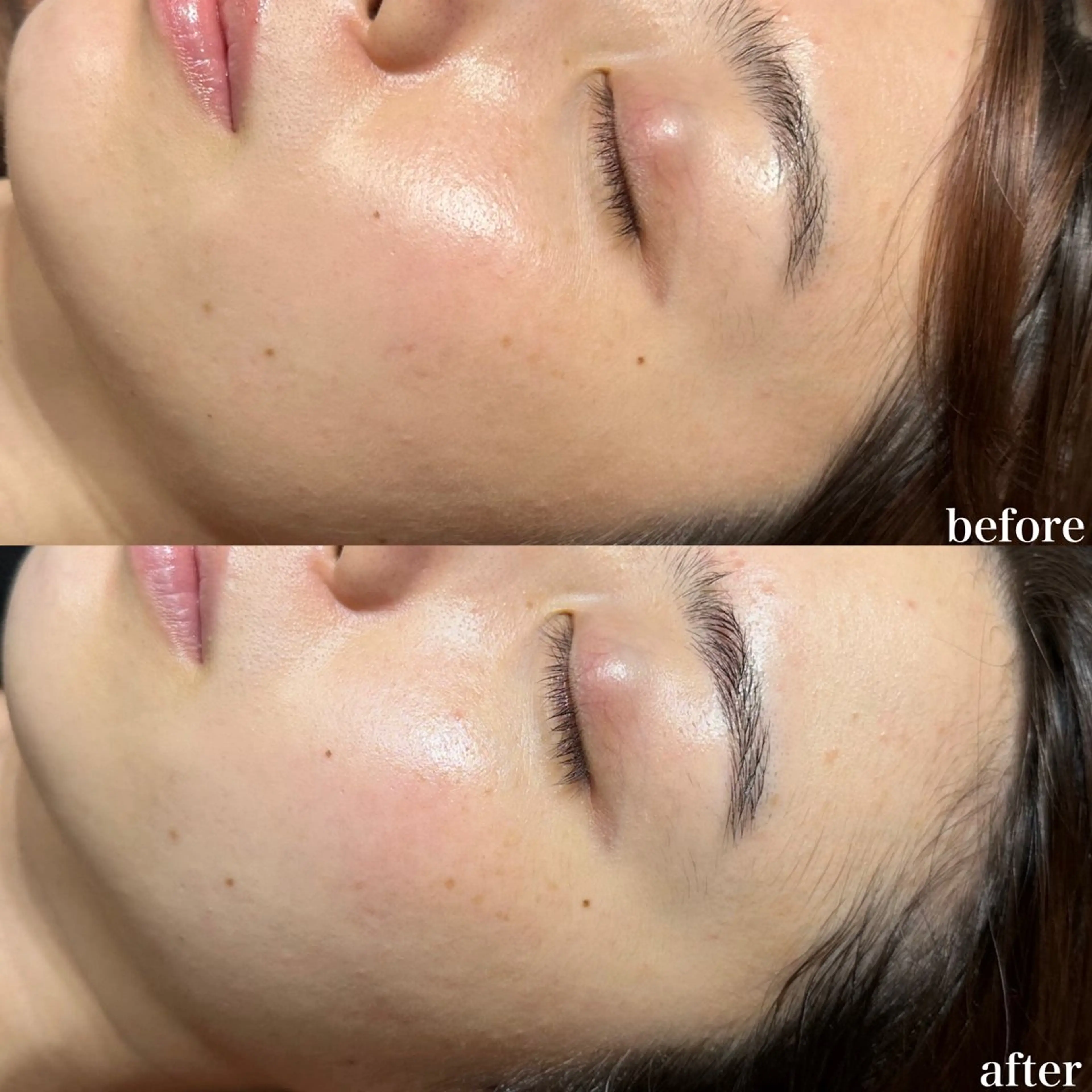 【美白専用】最強美白ケア◎内側から透明感のある肌へ(クリスティーナ)の写真