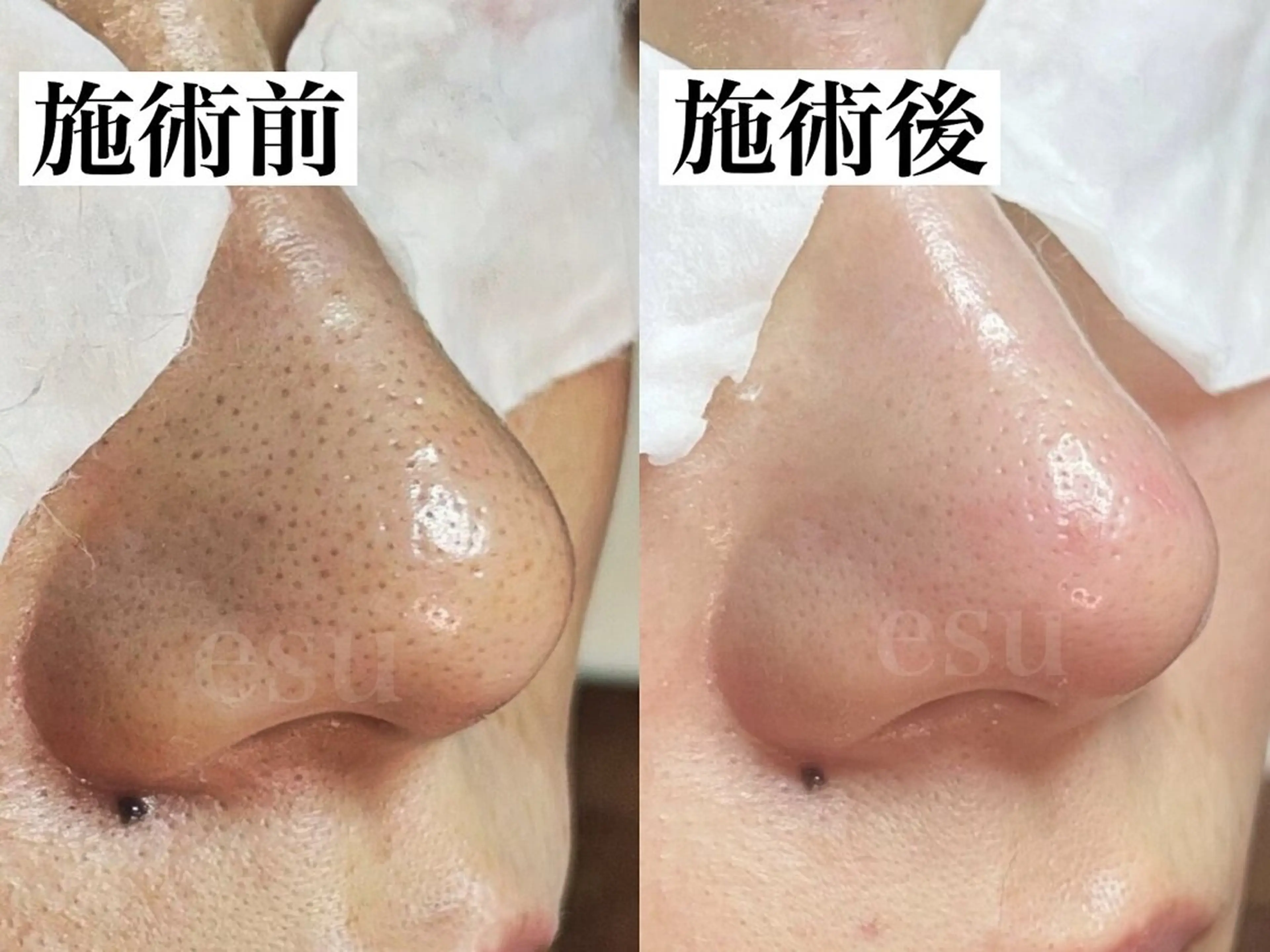 毛穴ケア専門店 esu(エス)のエステ・リラクイメージ