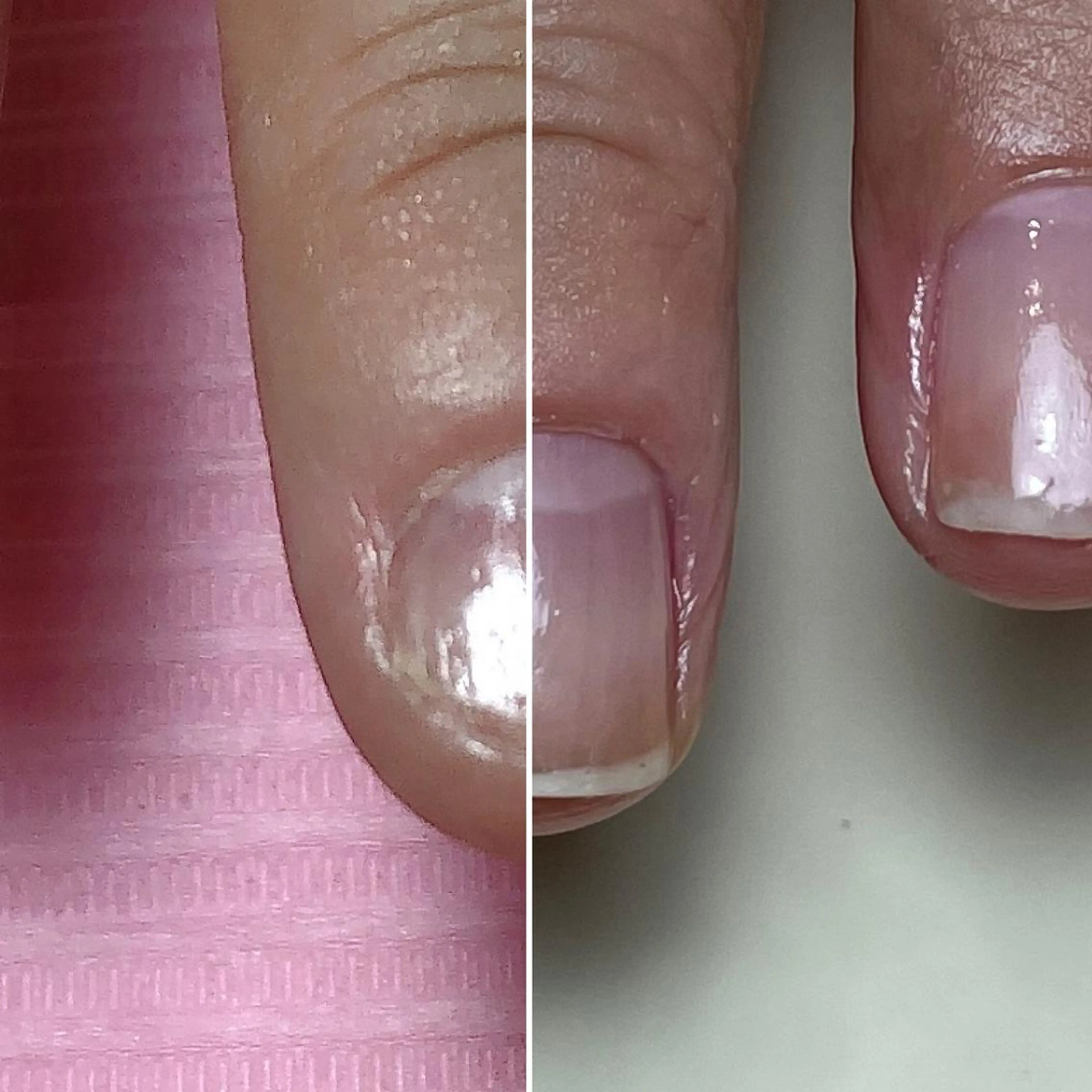 ネイル Nail ビ爪のネイルデザイン