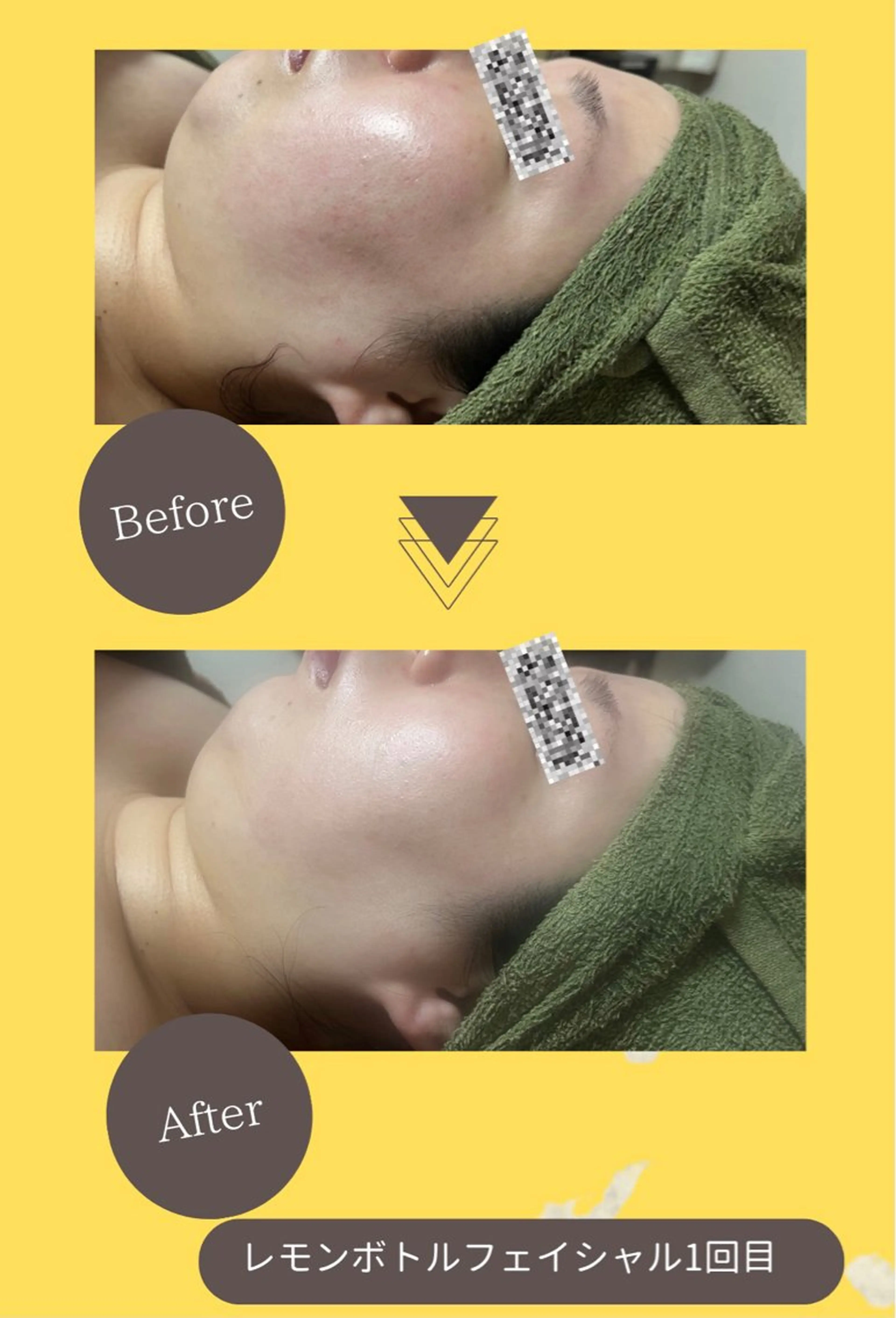 エステ バスト美肌小顔専門 Mimpi【ミンピ】のエステ・リラクイメージ