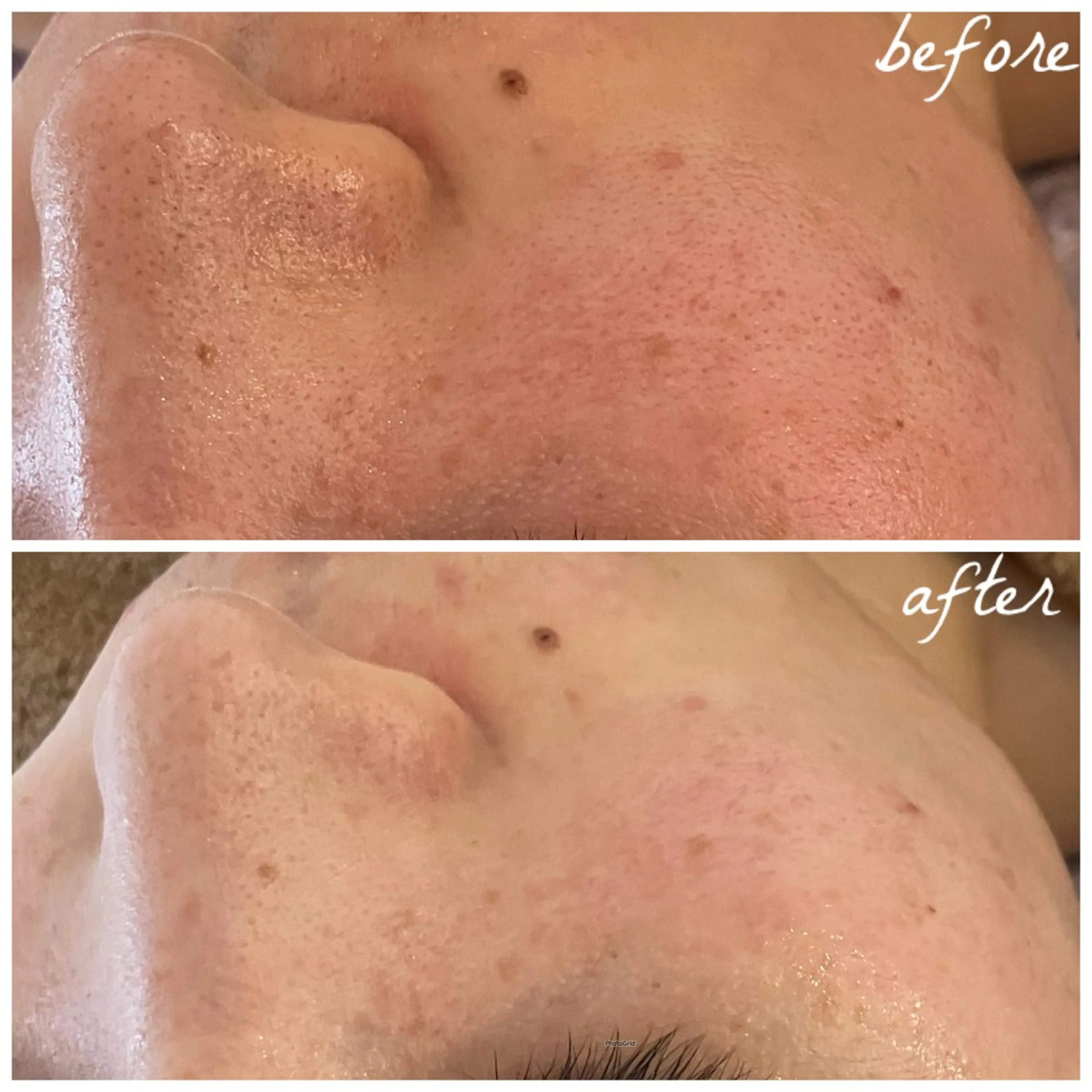 メンズ エステ メナード岐阜茜部 杉浦のエステ・リラクイメージ