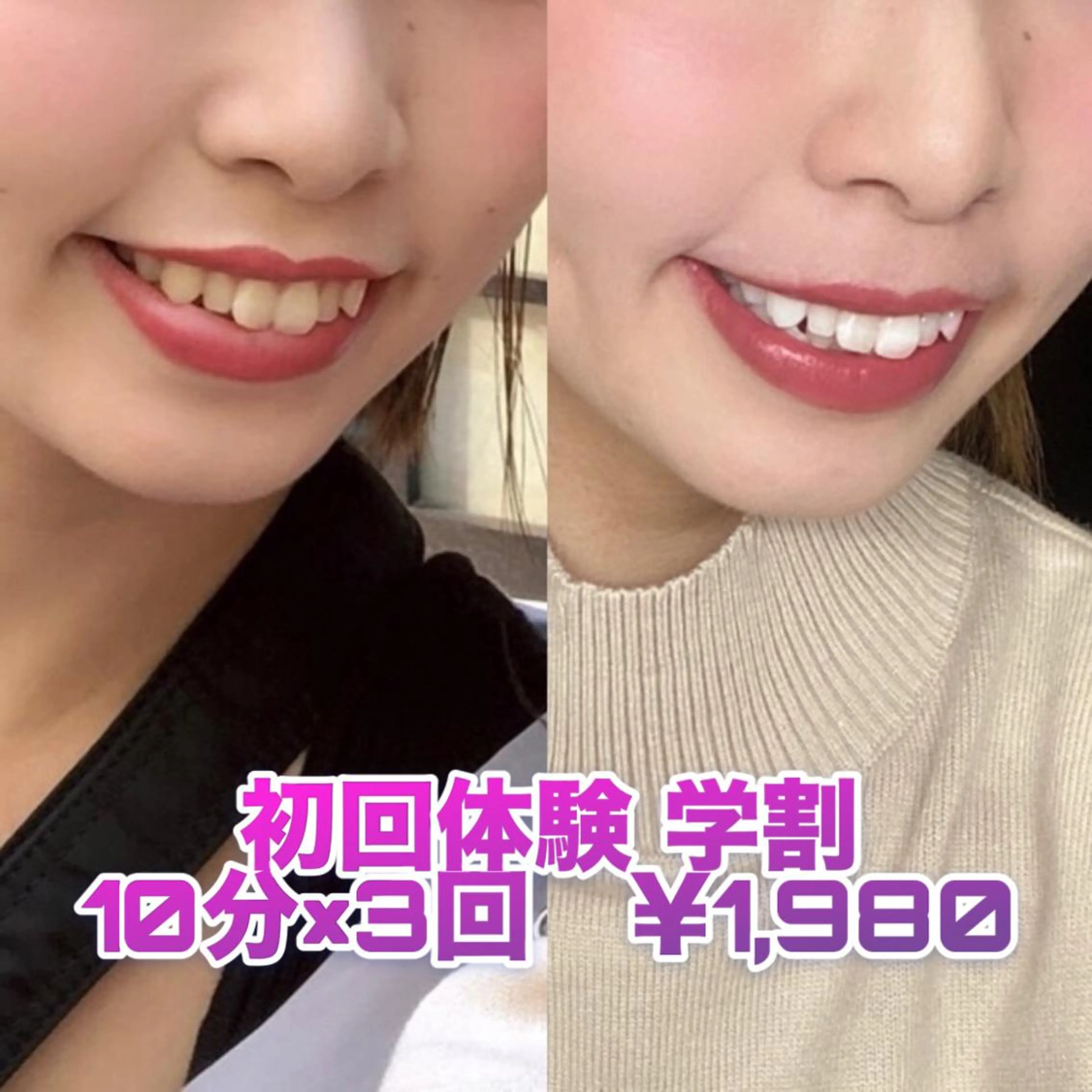 【1日3名様限定】🌟初回体験🌟学割👩‍🎓セルフホワイトニング10分×3回​〜​安心のカウンセリング付き​〜​✨✨の写真