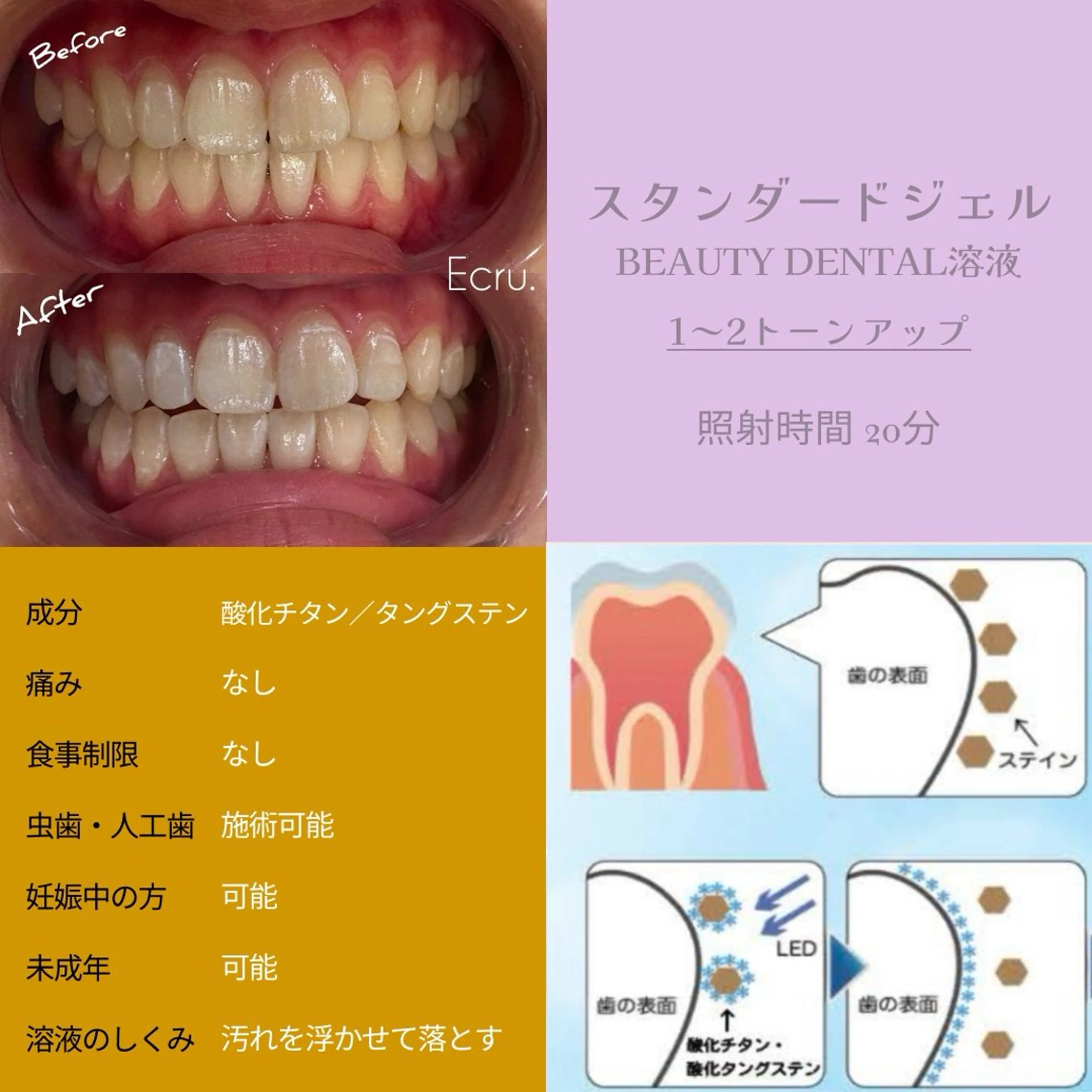 メンズ キッズ ホワイトニングサロン Ecru所属・ホワイトニングサロン Ecru エクリュのその他イメージ
