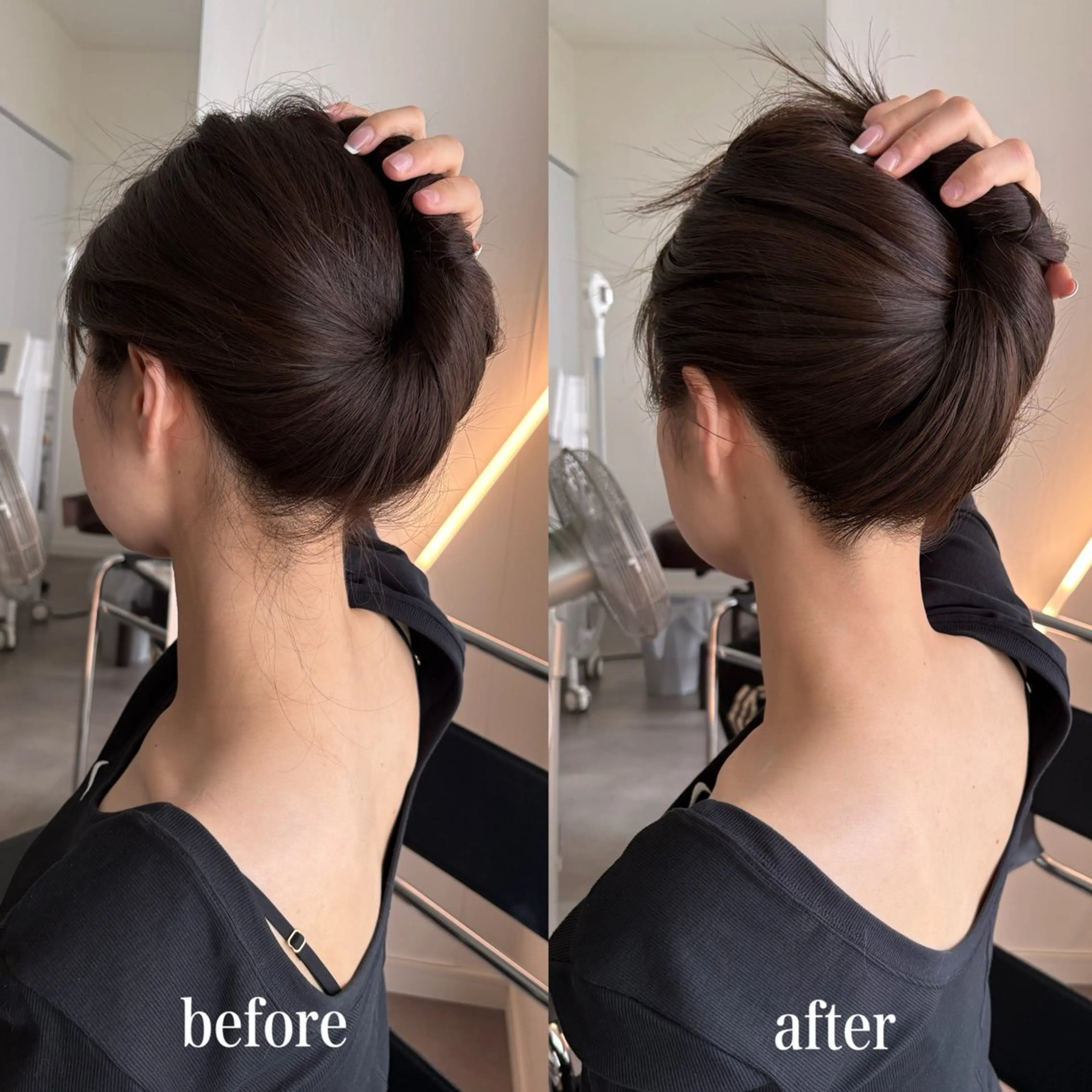 【新規限定】女性👧🏻 Mパーツ脱毛(うなじ/ひじ上/ひじ下のいずれか)の写真