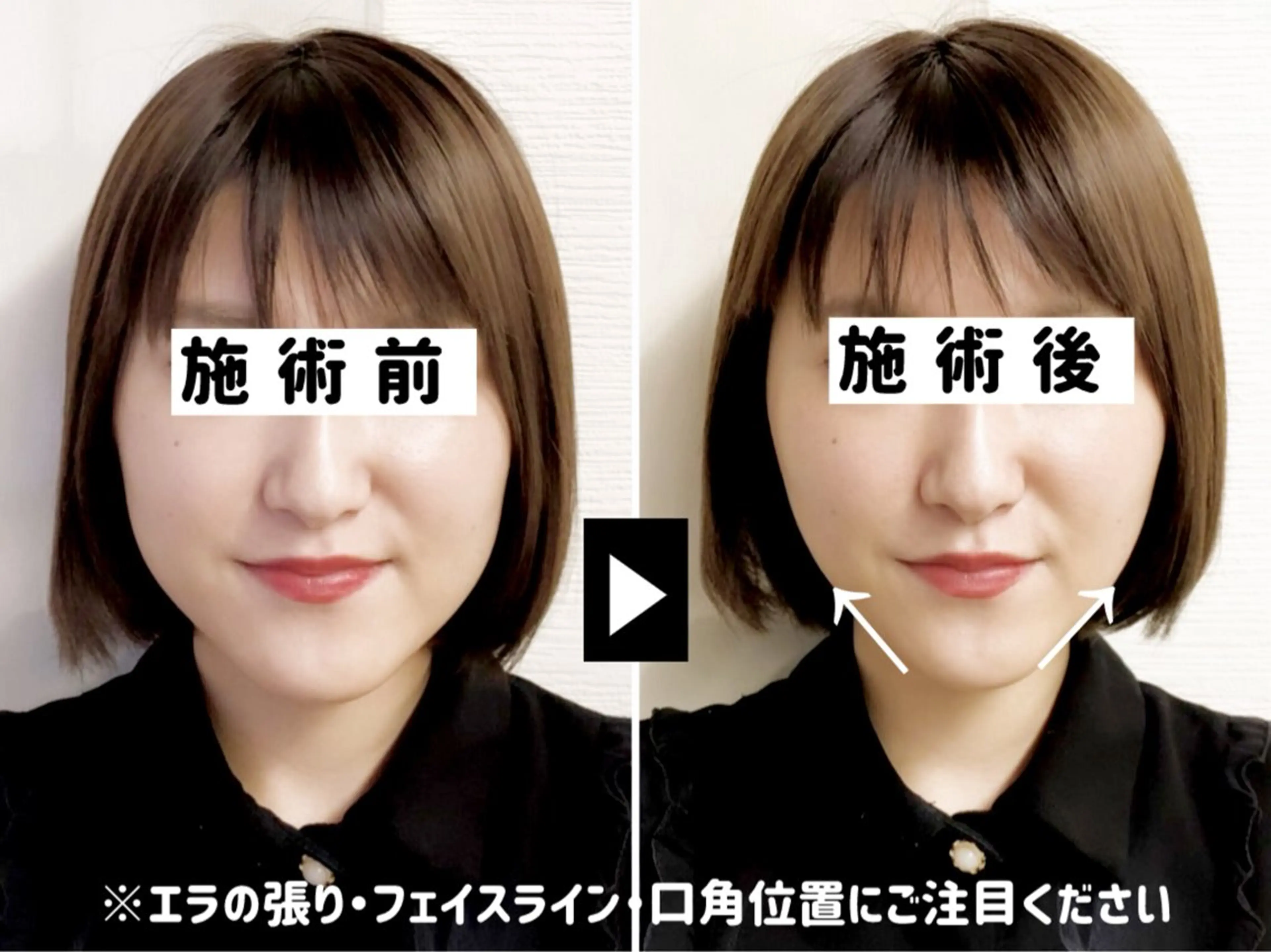 エステ リラク 小顔美容鍼専門サロン 渋谷YZのその他イメージ