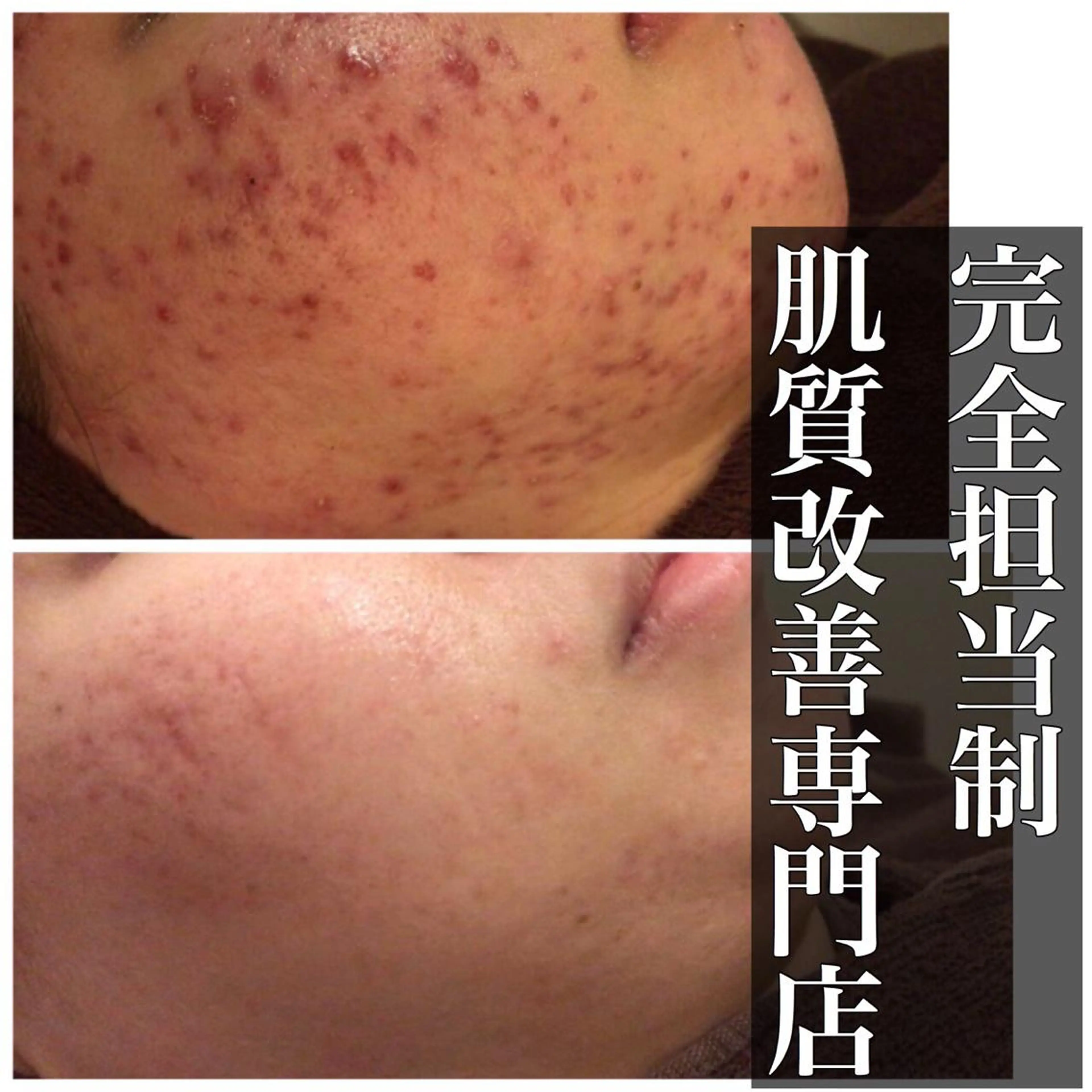 ミディアム カラー パーマ ヘアアレンジ メンズ キッズ ネイル マツエク・マツパ エステ リラク ニキビ・肌質改善専門 ♡人生が変わるサロンのエステ・リラクイメージ