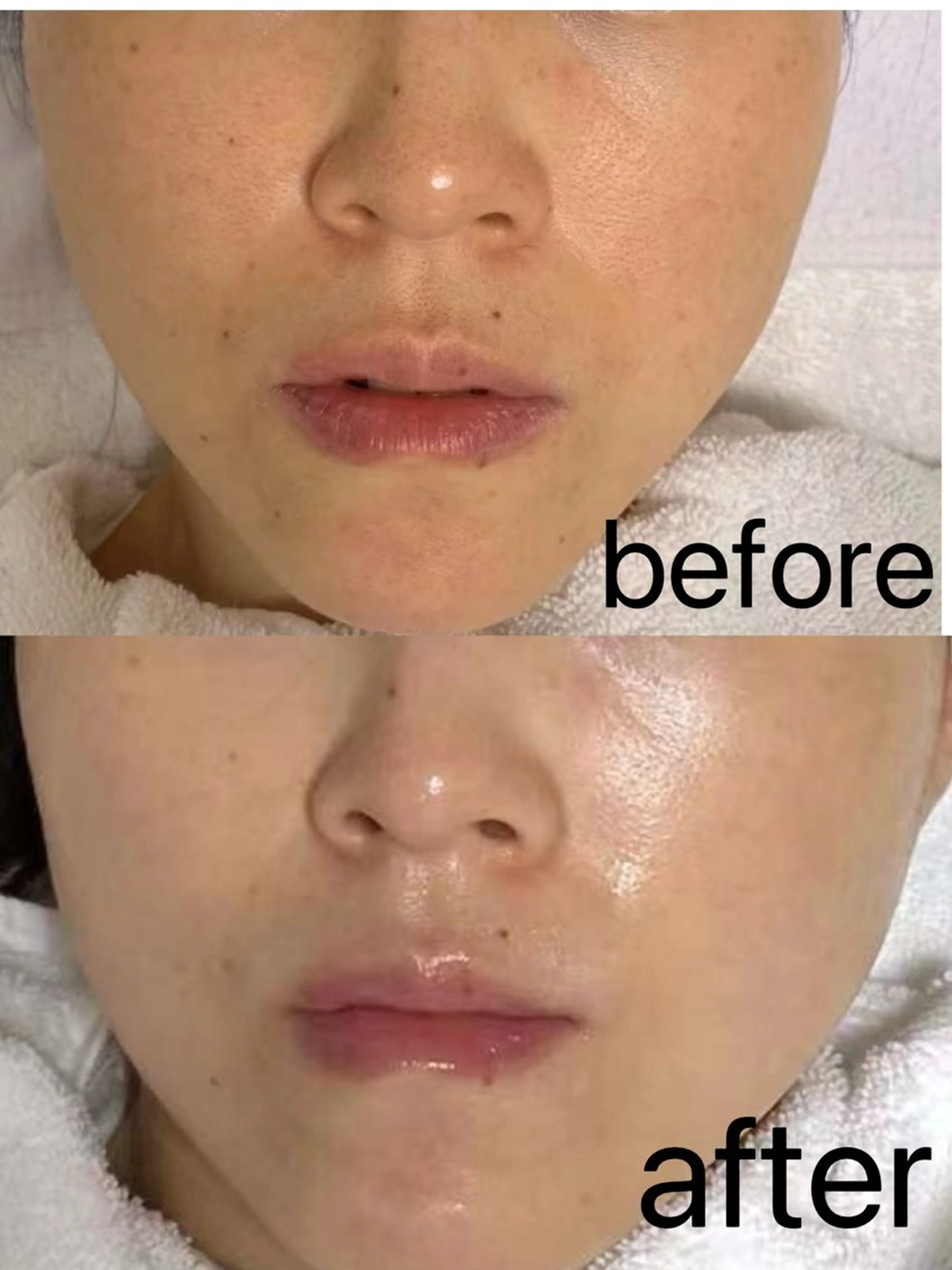 Nature Souce毛穴専門店のその他イメージ