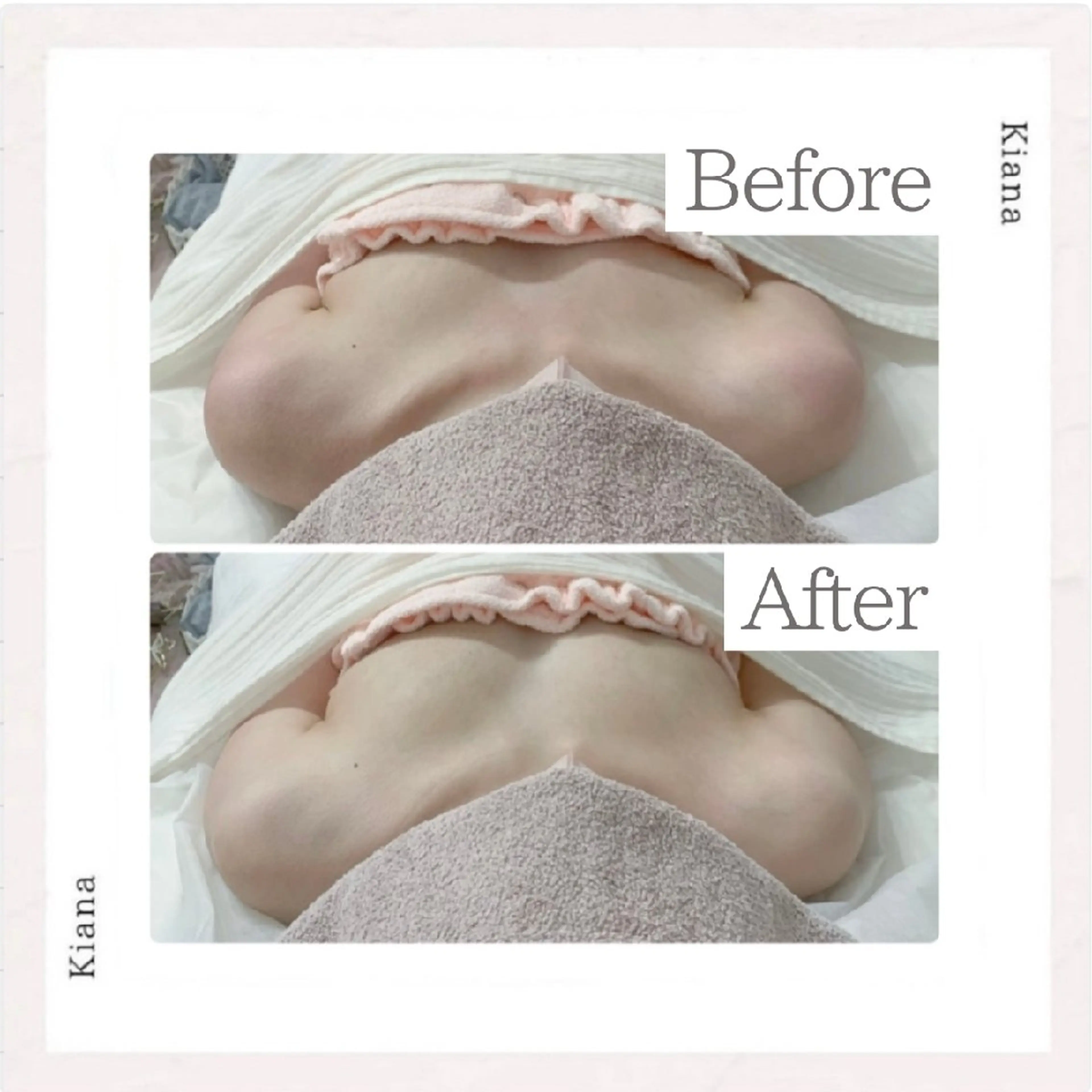 エステ リラク 【バスト専門店 】 Kiana のエステ・リラクイメージ