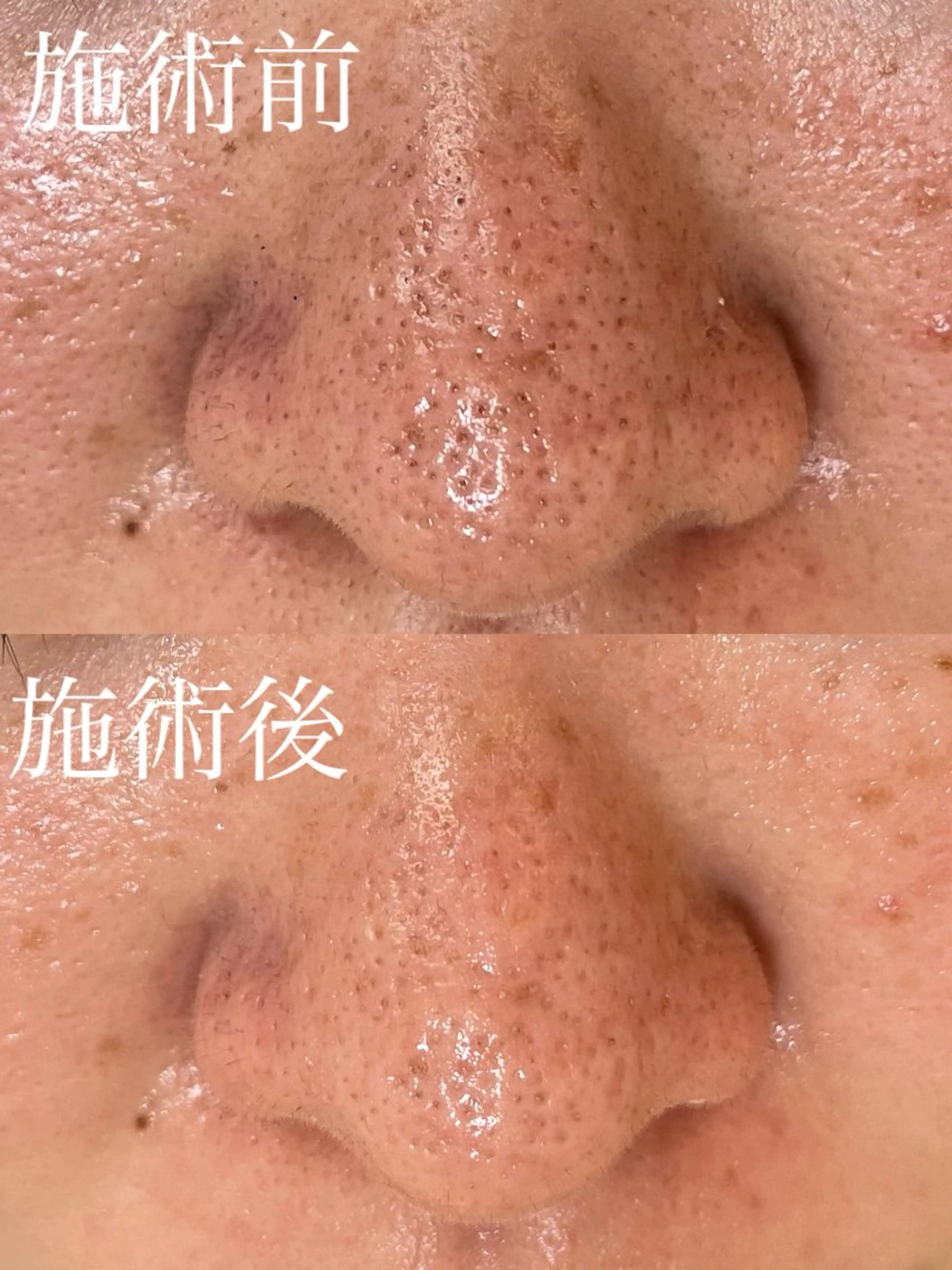 トータルビューティー サロンLilyのエステ・リラクイメージ