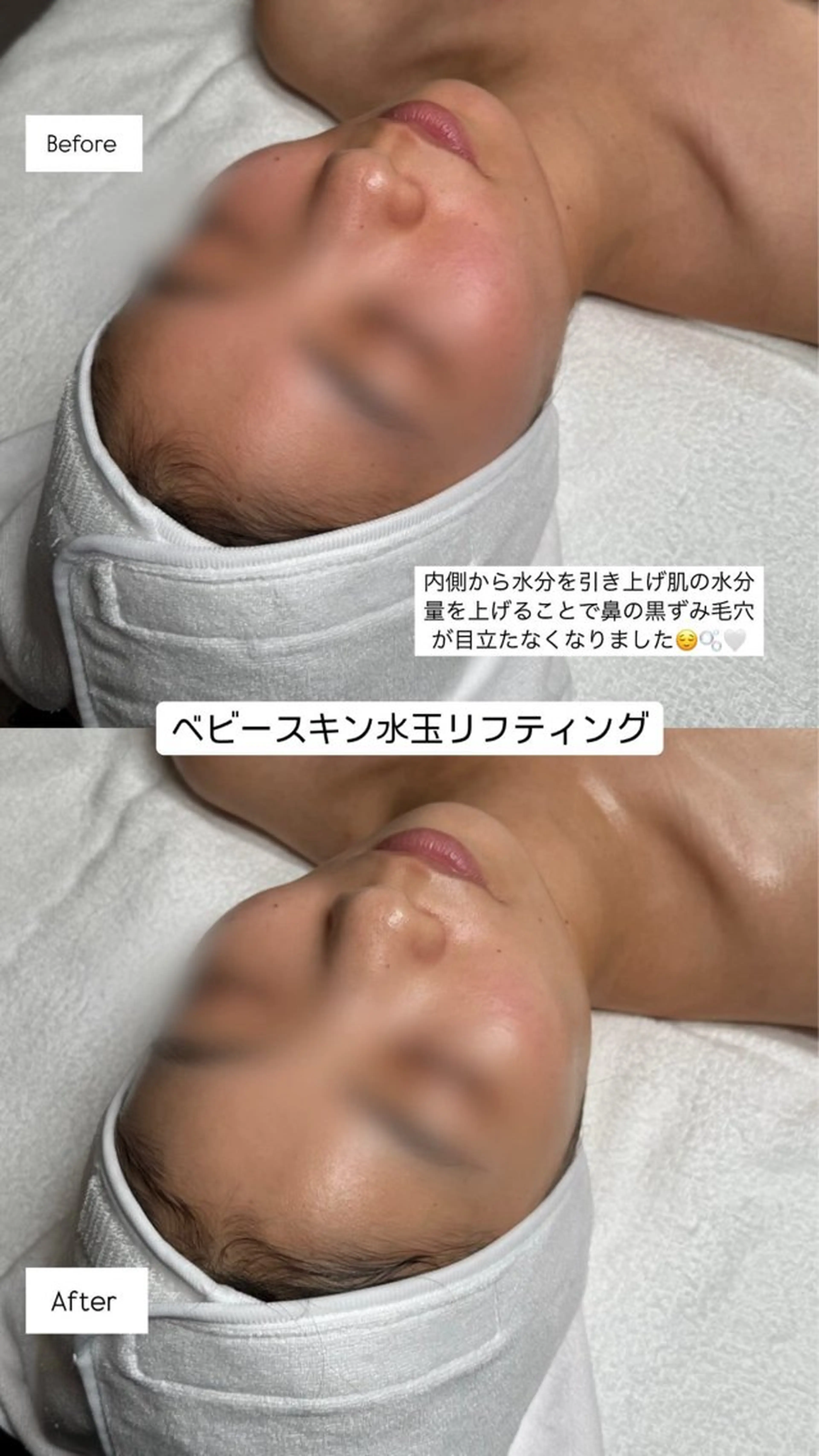 韓国肌管理🫧LDM 🫧Junnaのエステ・リラクイメージ