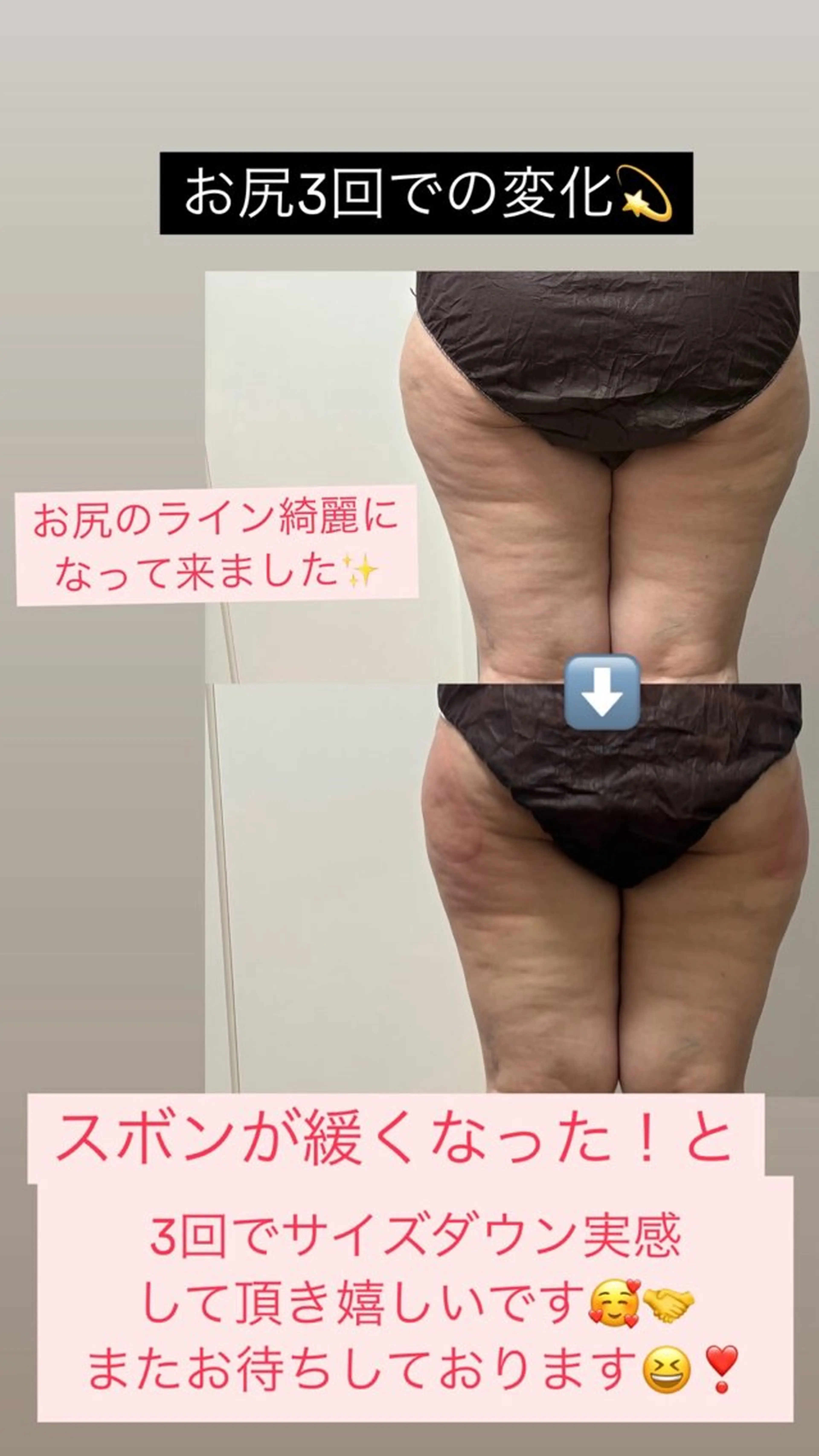 エステ Miiju.所属・Miiju. 石巻市 脂肪冷却  鈴木のエステ・リラクイメージ