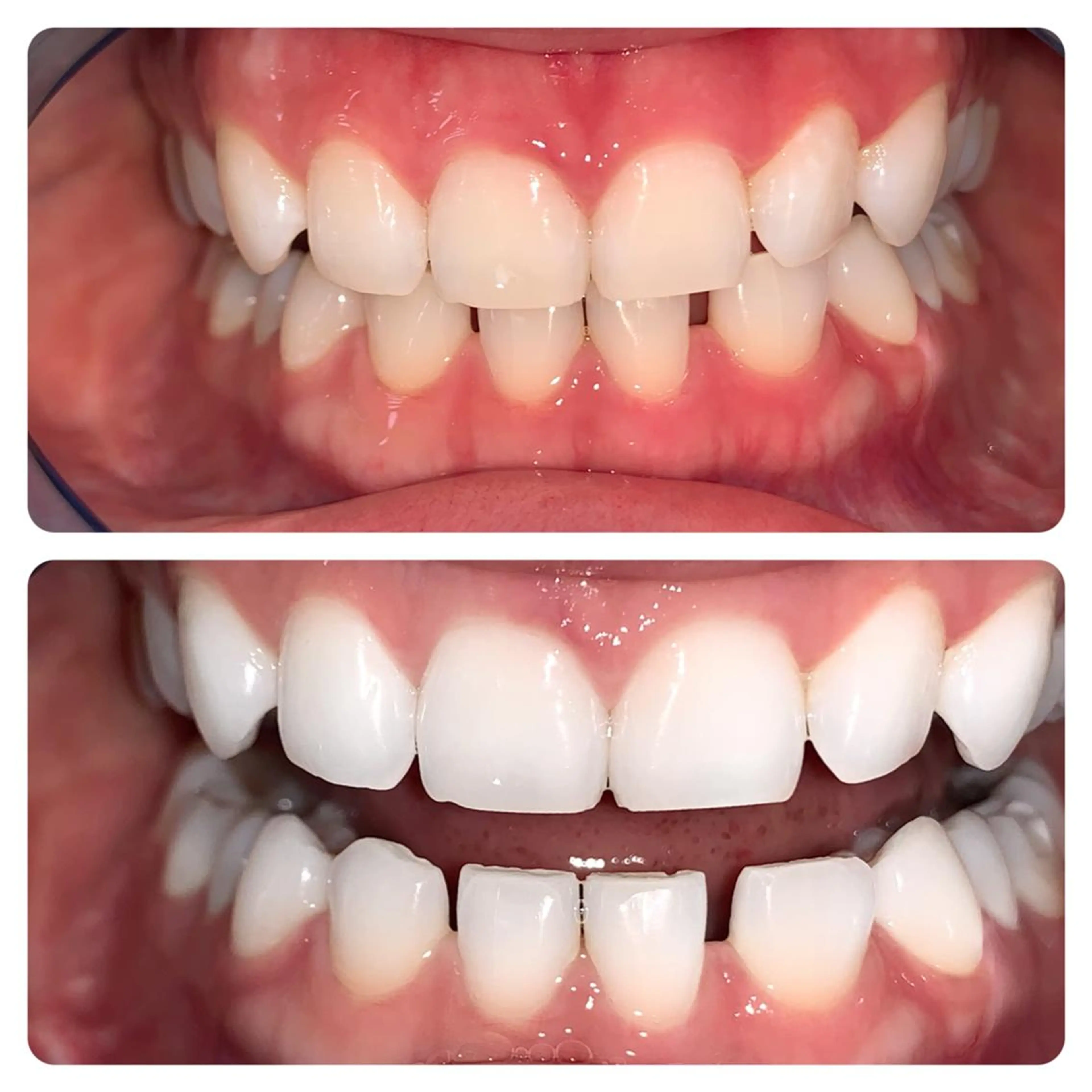 ショート ヘアアレンジ ネイル マツエク・マツパ メンズ カラー パーマ アイブロウ キッズ ホワイト その他 ライトビューティー 銀座本店のエステ・リラクイメージ