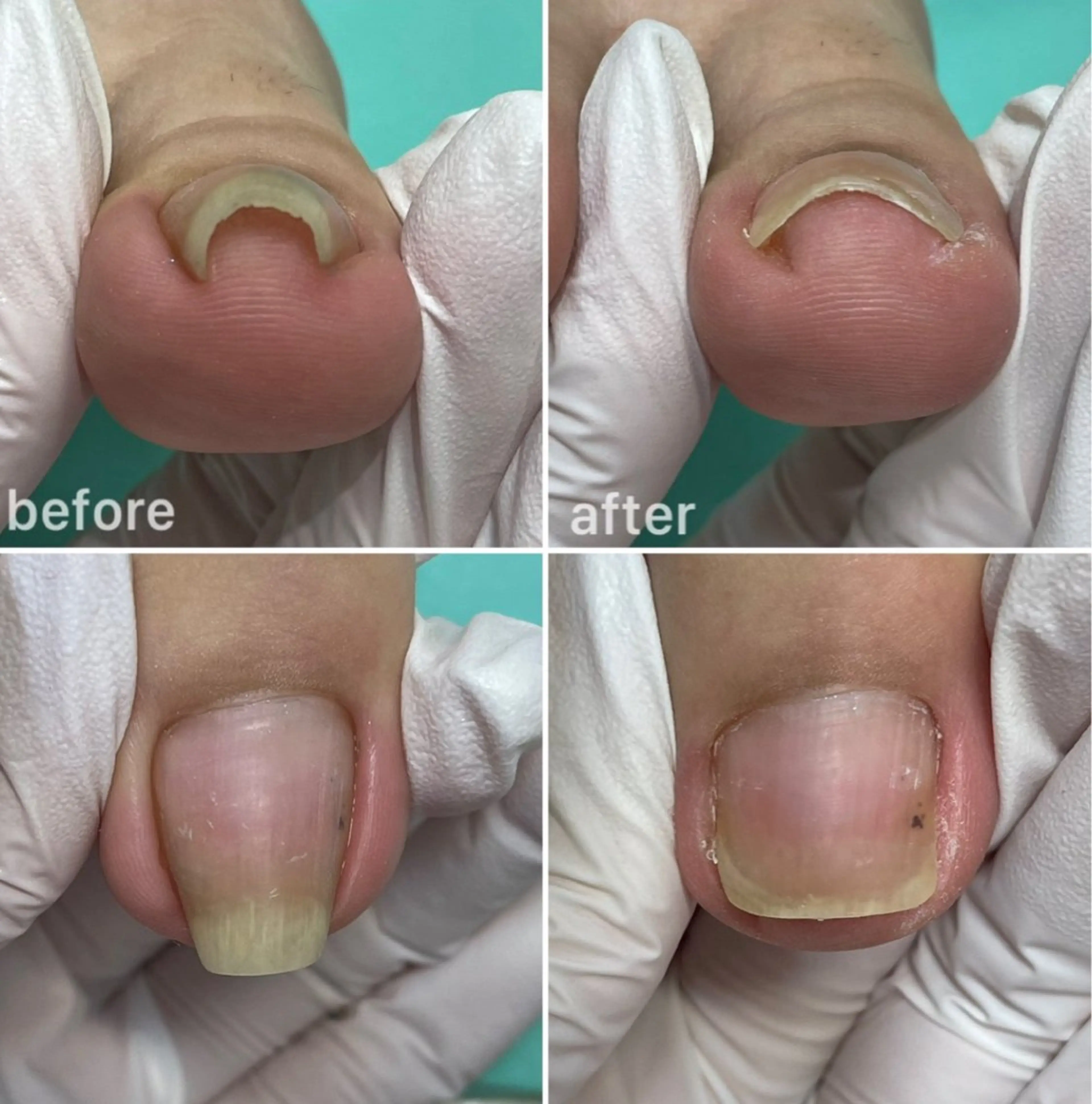 リラク 福岡巻き爪補正店 博多店のエステ・リラクイメージ