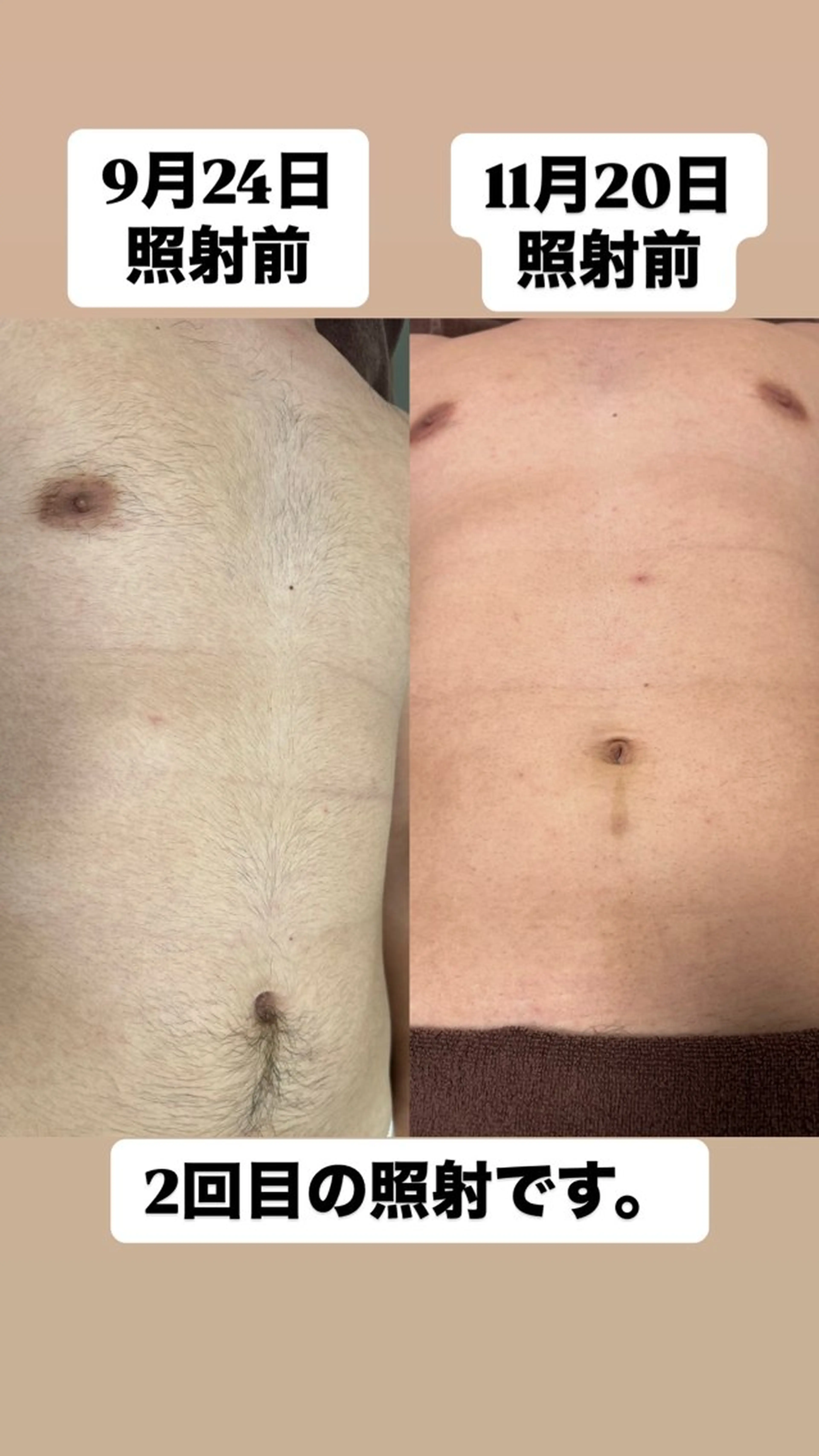 メンズ Beauty Salon EDEN つくば店所属・池田 純のエステ・リラクイメージ