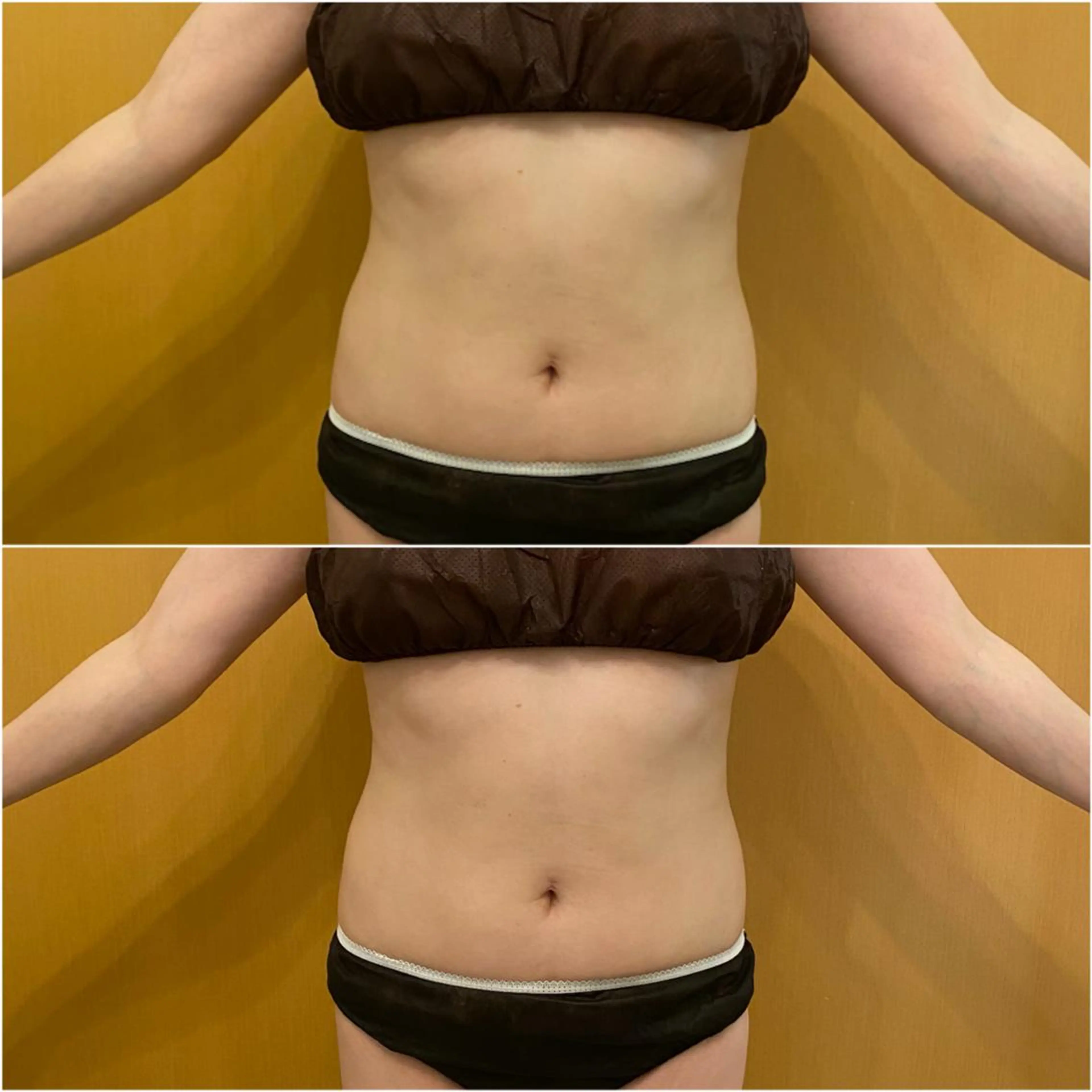 ✨美肌水光✨ アトリエリュバンのエステ・リラクイメージ