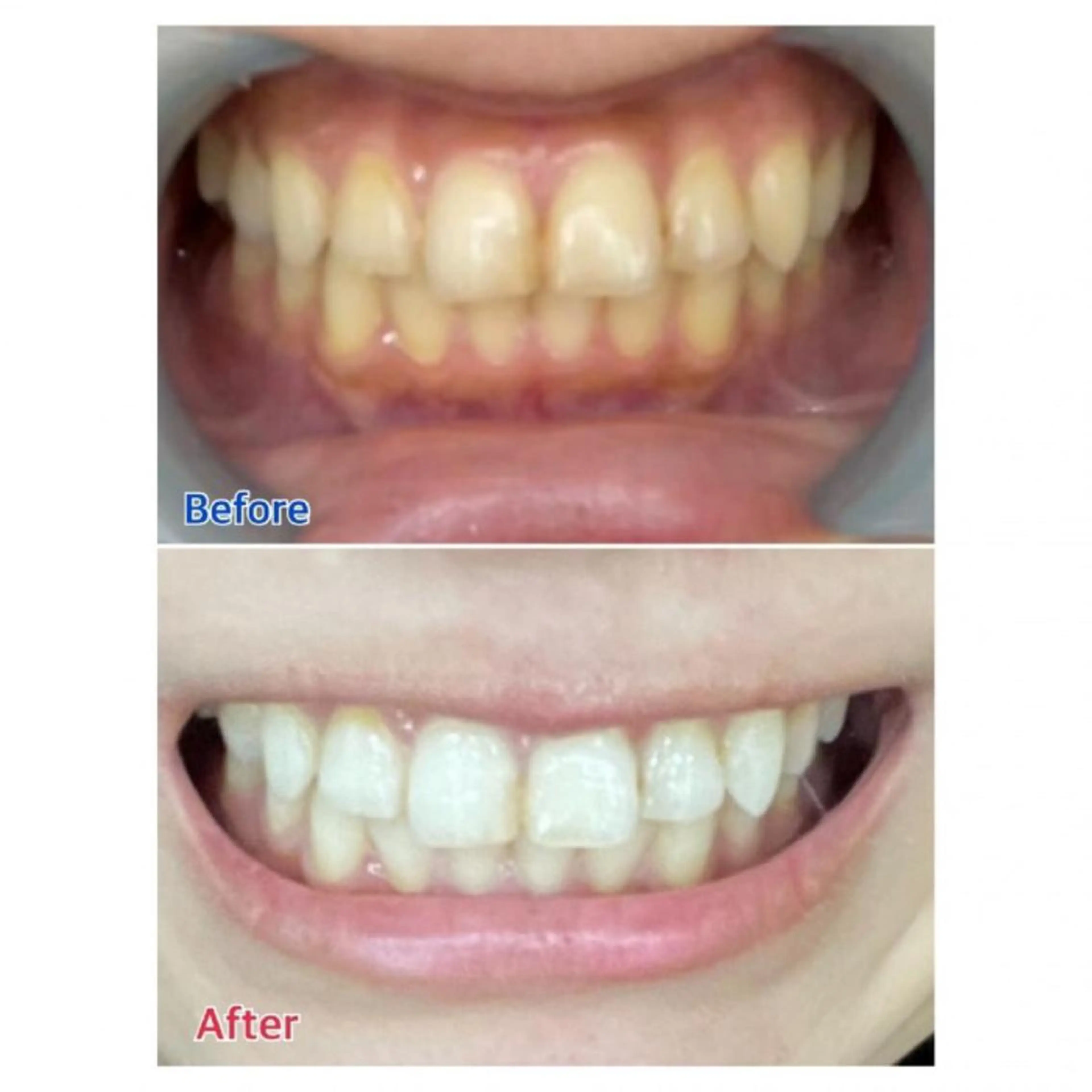 M渋谷店所属・Ｍ渋谷 ホワイトニングのその他イメージ