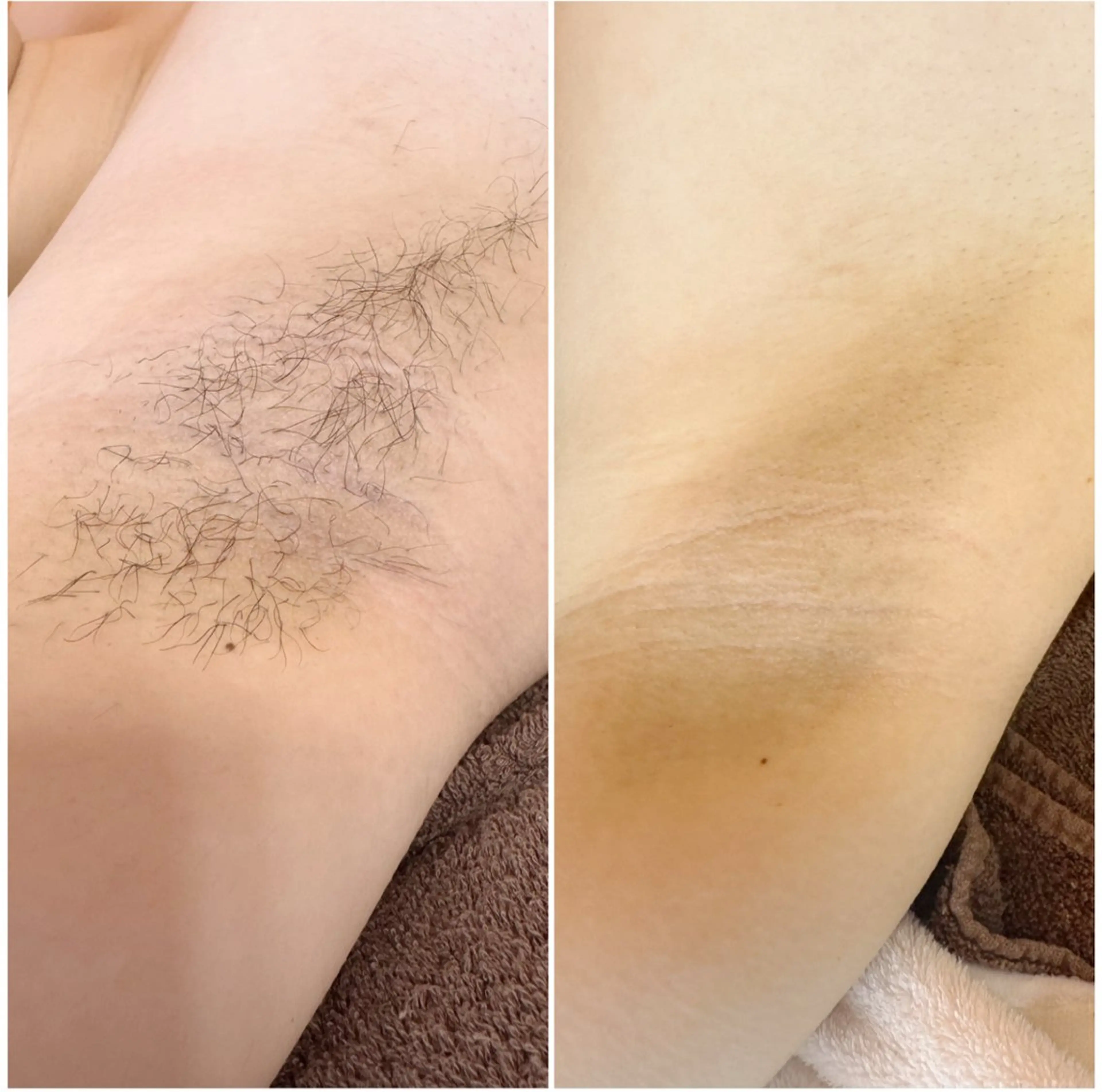 脱毛 Vonita Aiのエステ・リラクイメージ