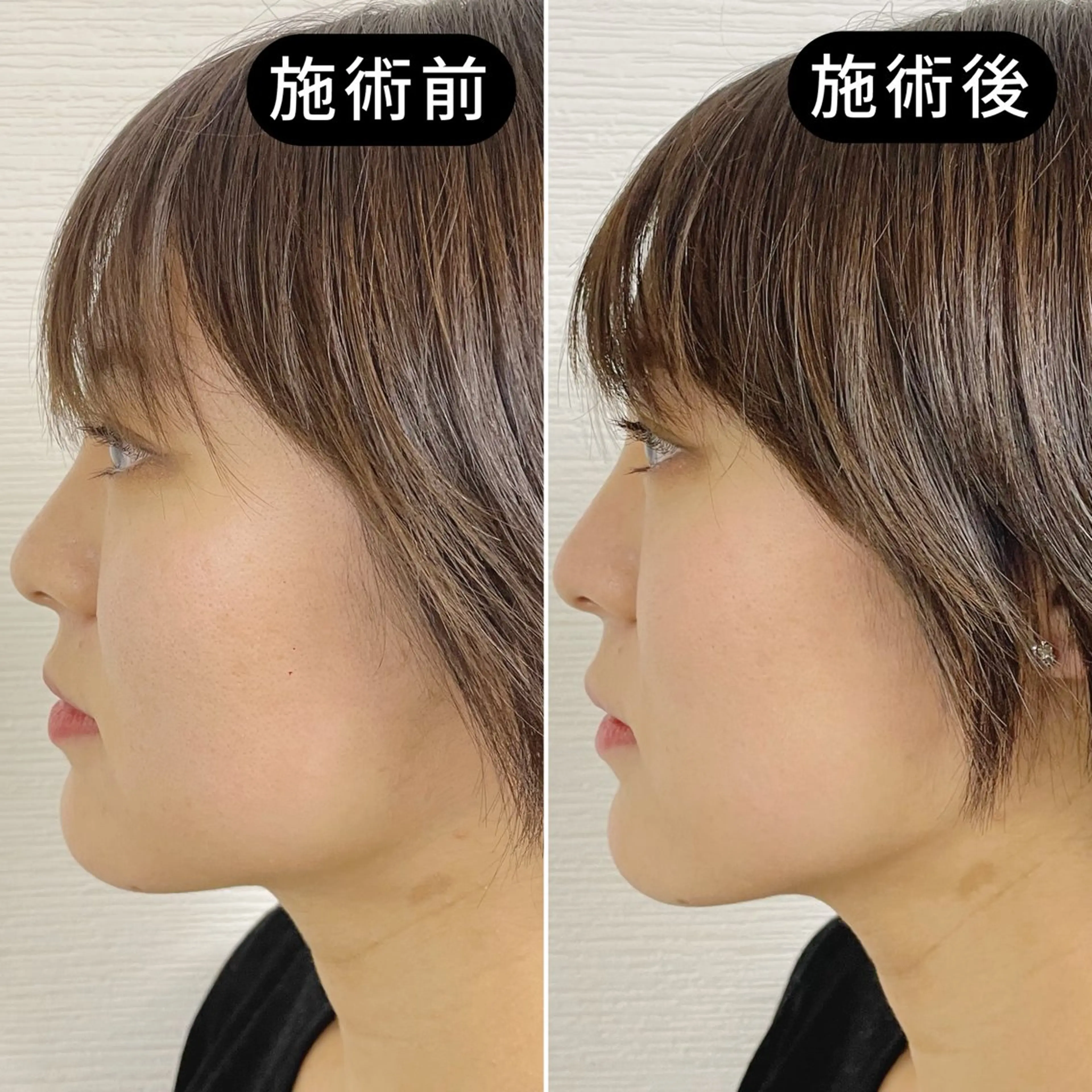 エステ リラク 渋谷 小顔美容鍼 専門サロン YZのエステ・リラクイメージ