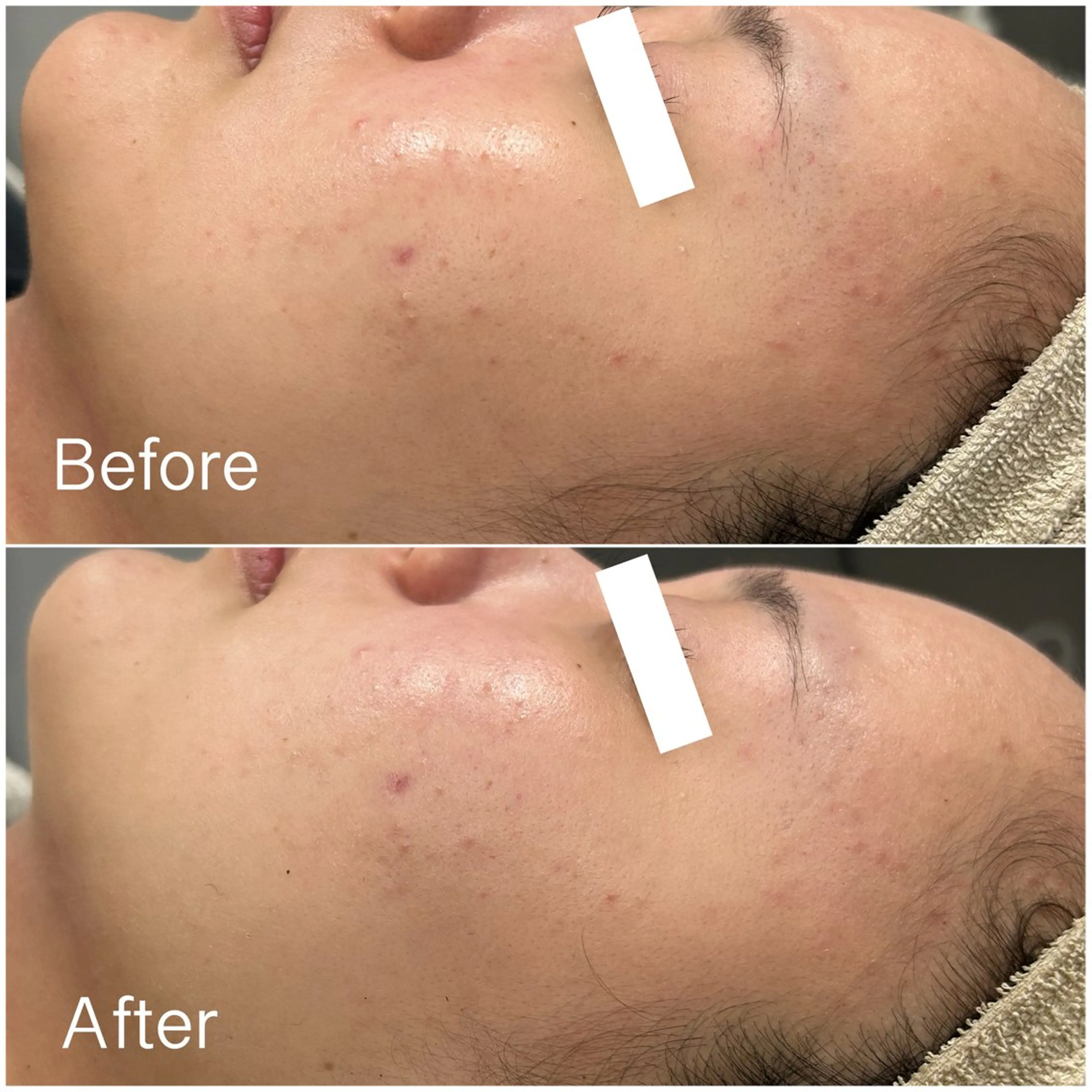 エステ 垣田 ジョアアンジェ京橋のエステ・リラクイメージ