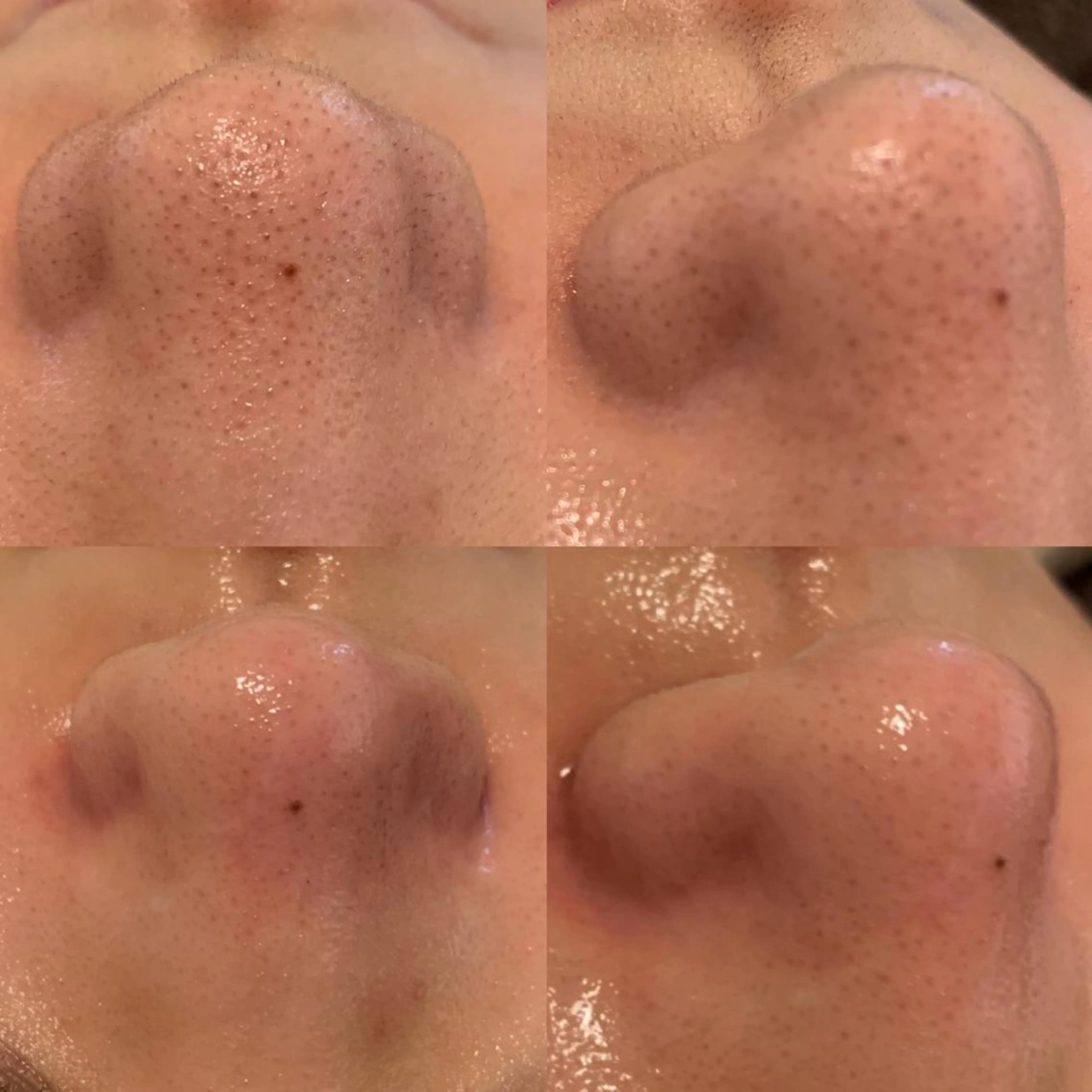 エステ リラク BELCIA福岡店　récolte de BELCIA（レコルトデベルシア）所属・BELCIA福岡店 レコルトデベルシアのエステ・リラクイメージ