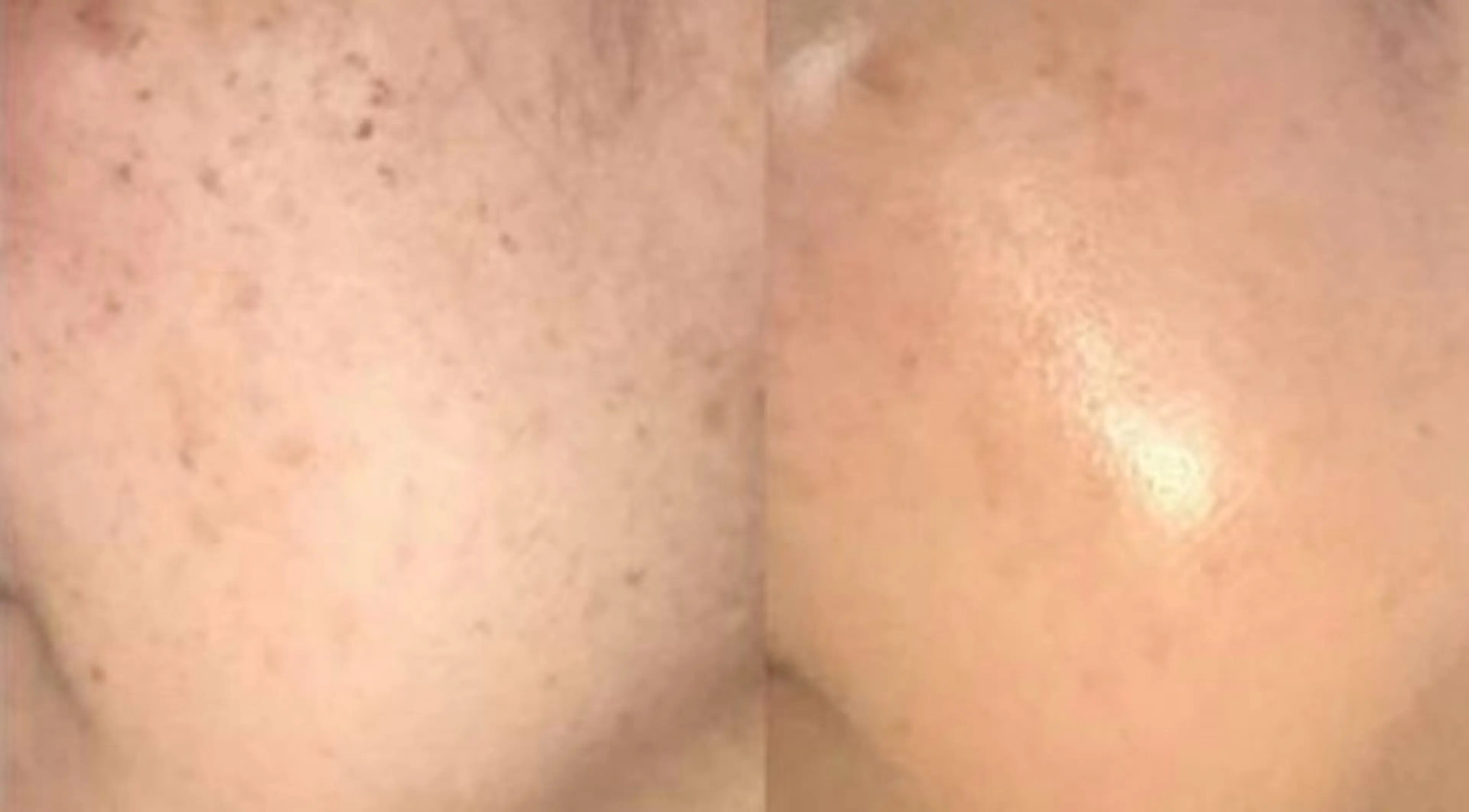 韓国肌になれる✨️光フォト(顔)ニキビ、シミなどあらゆる肌悩みに効果あり‼️の写真