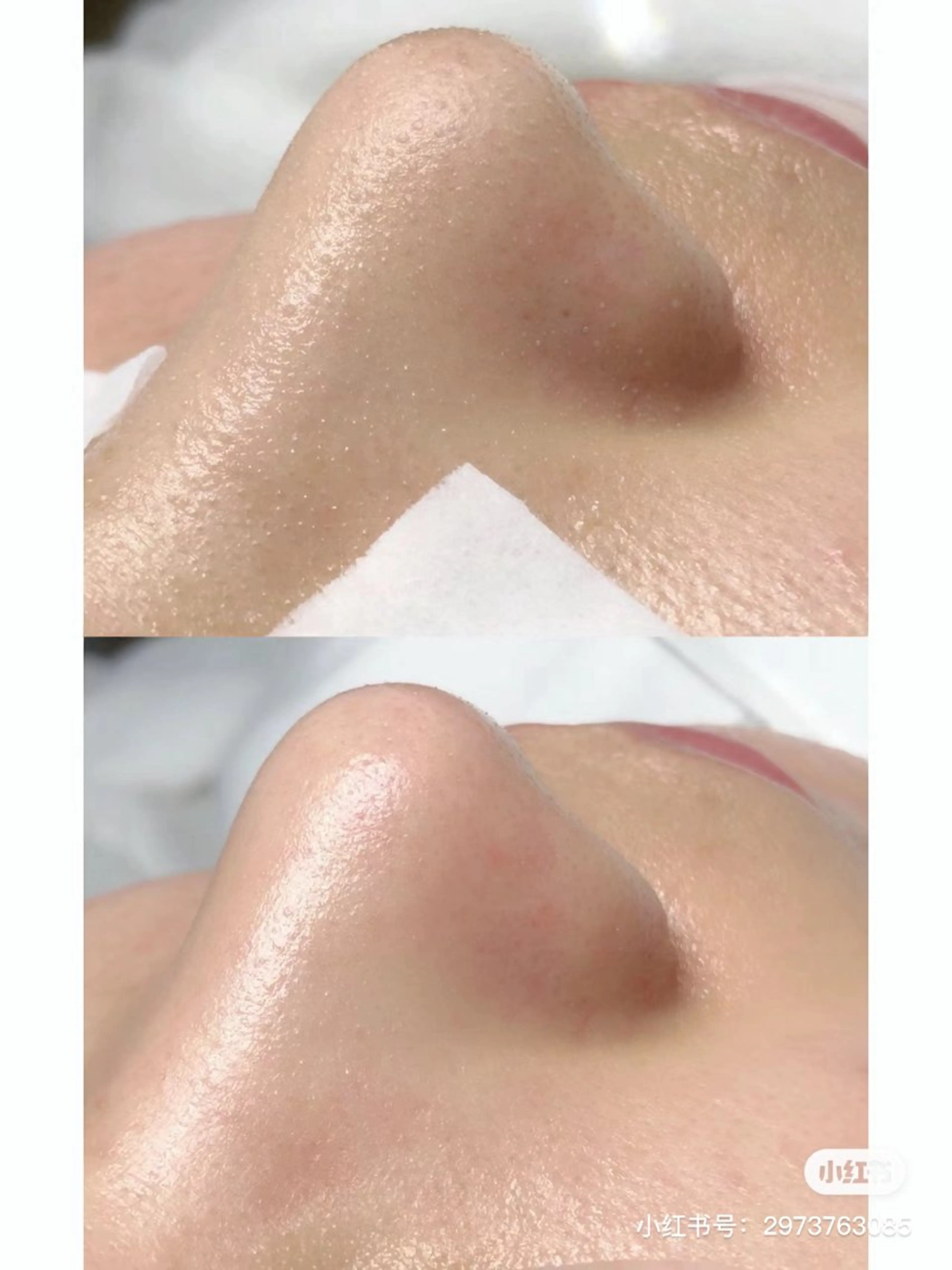 ネイル エステ aliaハイフ&水光ジェットサロン所属・aliaハーブ水光店 エステティシャン募集のエステ・リラクイメージ