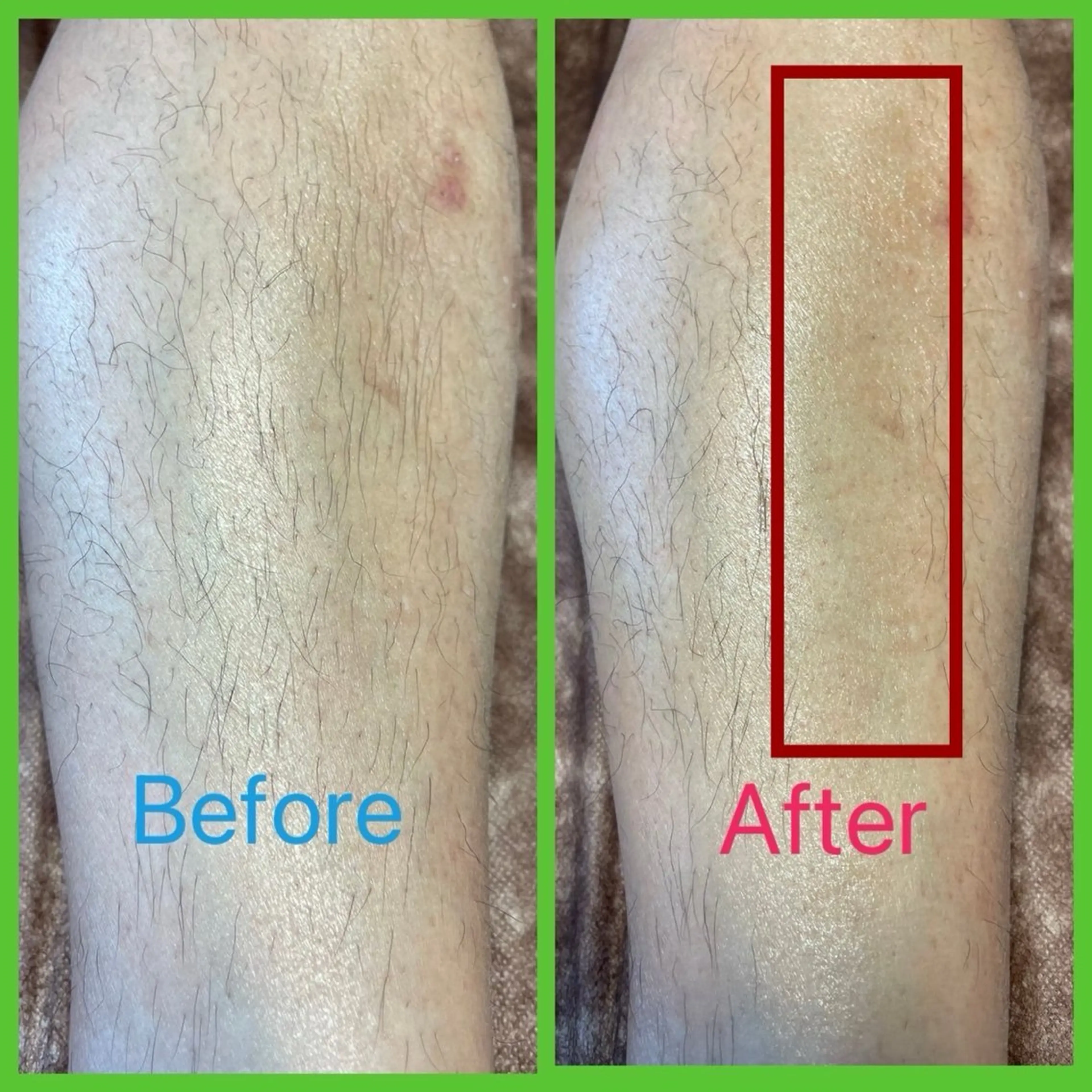 脱毛 FREDONNER hommeのエステ・リラクイメージ