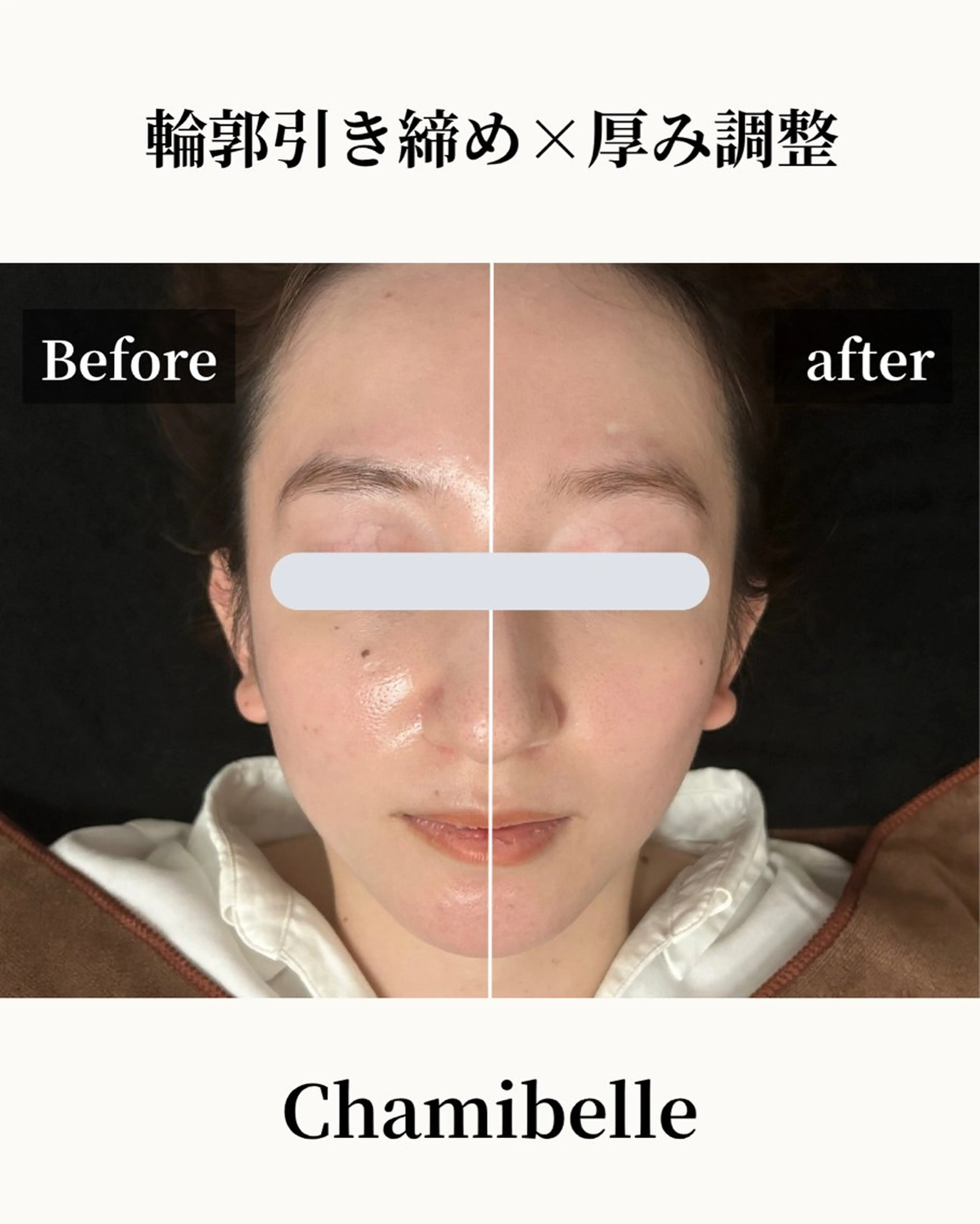 美容鍼灸サロン Chamibelleのエステ・リラクイメージ