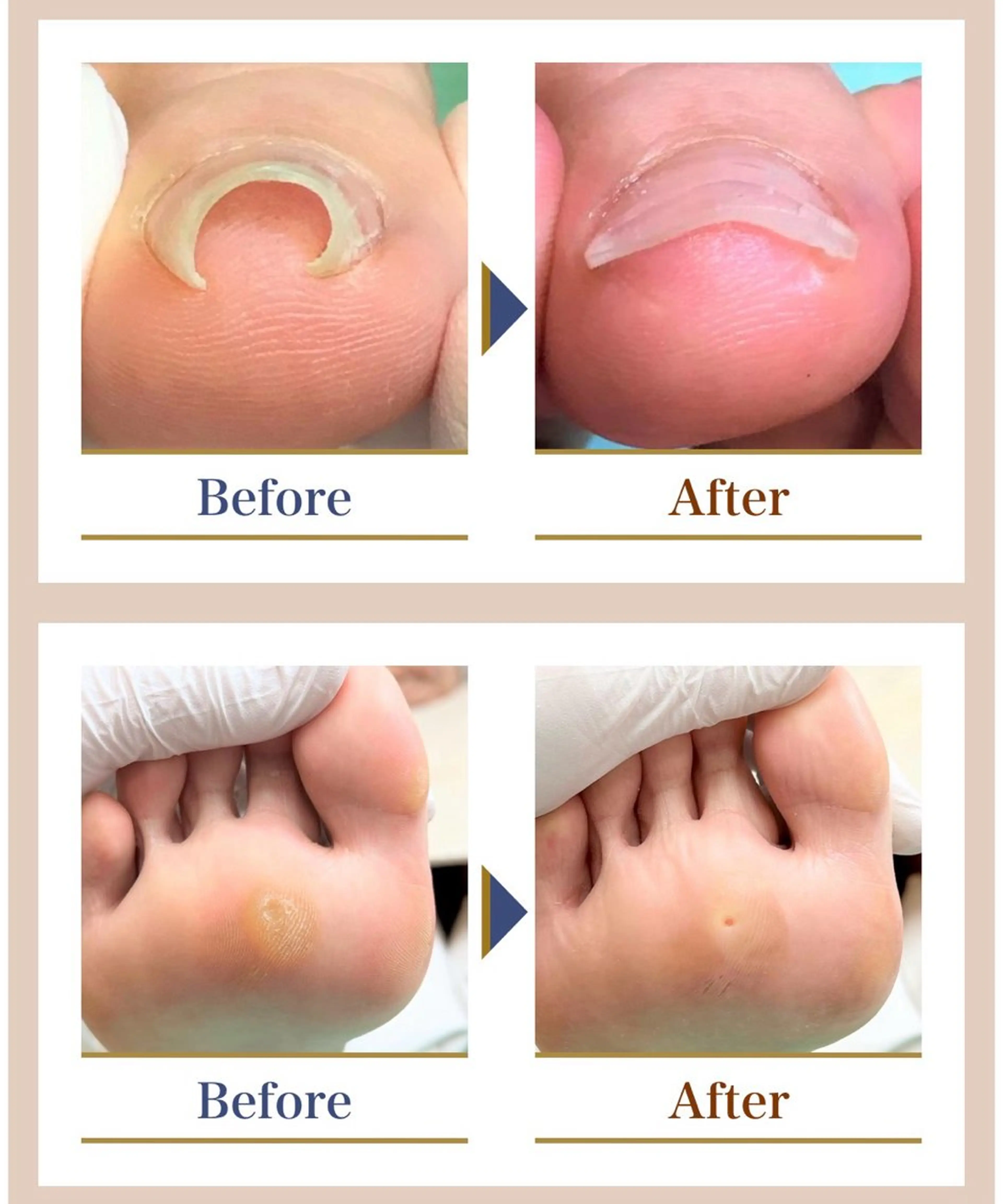 リラク 巻き爪補正店越谷店所属・巻き爪補正店 越谷店のネイルデザイン