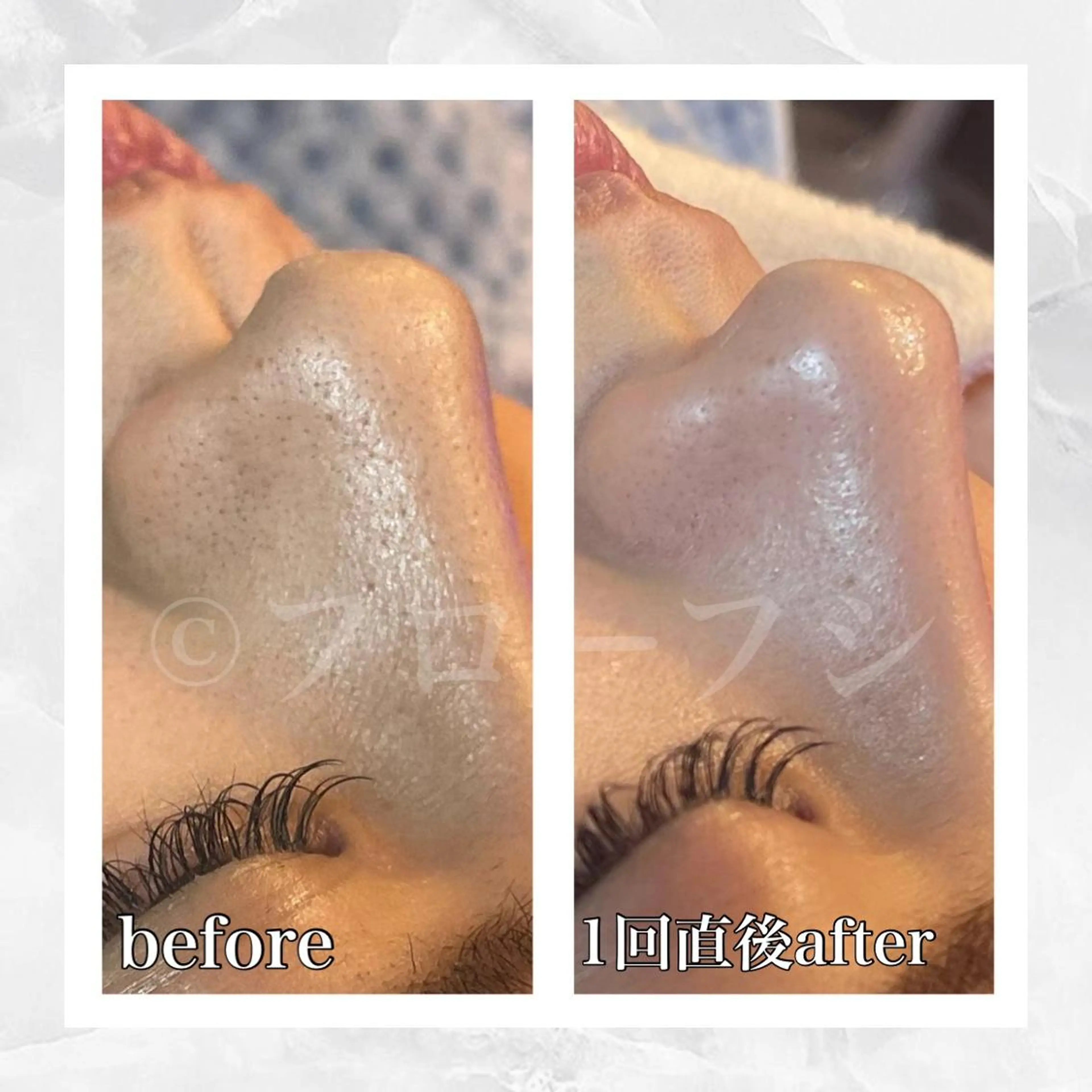 部分痩せ♥️小顔専門 MIKUのエステ・リラクイメージ