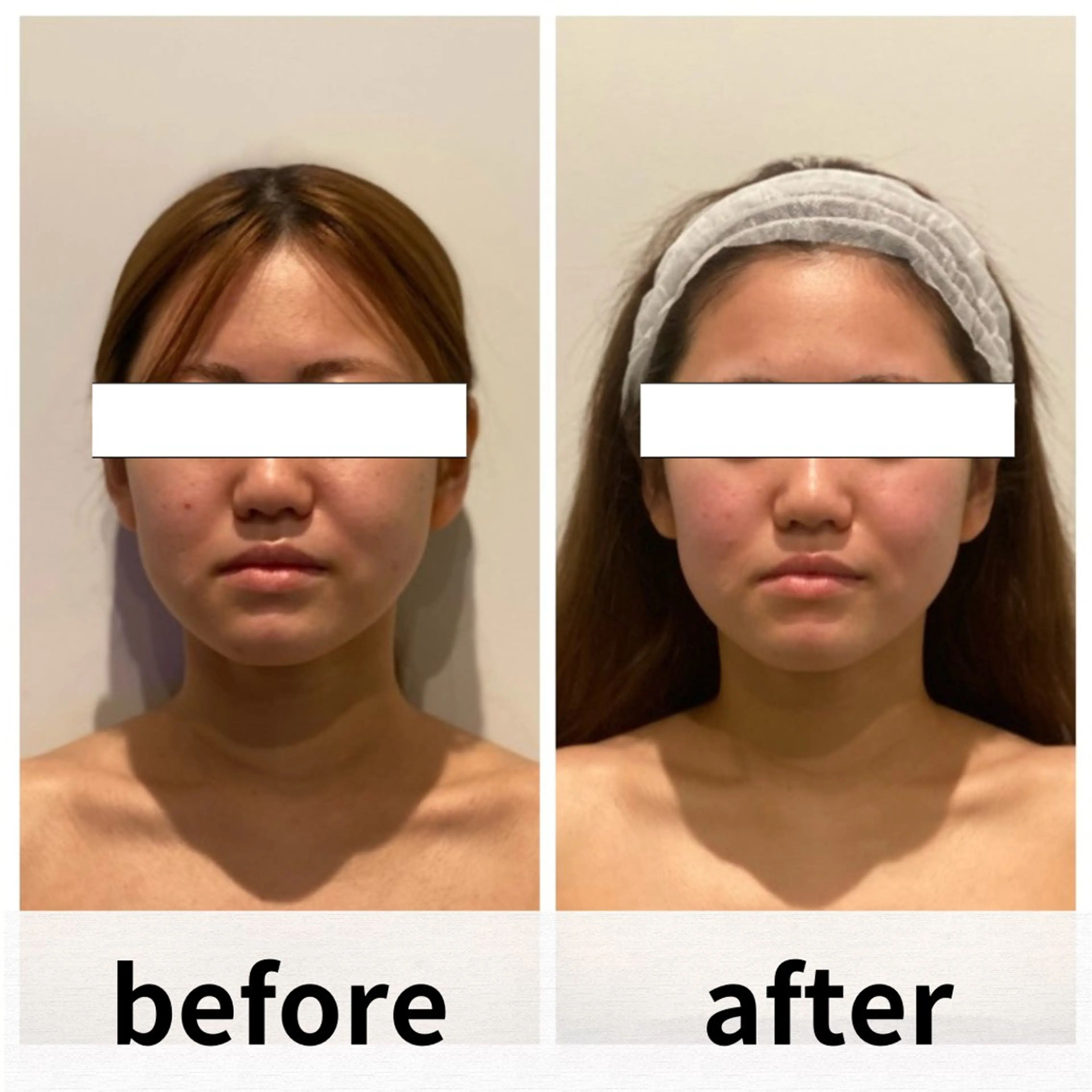 エステ リラク 美容鍼/ヘッドスパ/ 💎さかもとのエステ・リラクイメージ