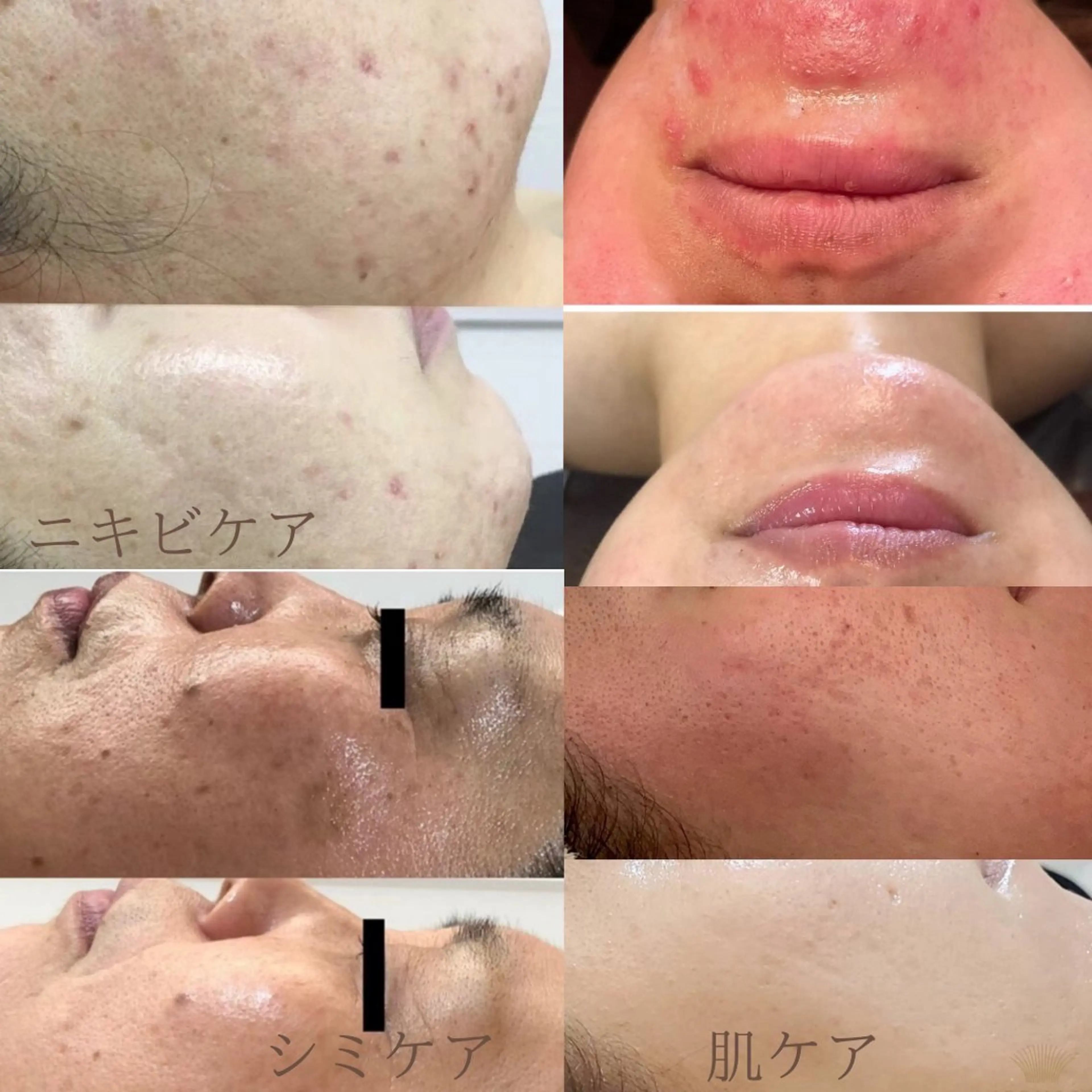 ホワイトニング・ハーブピーリング・フェイシャルサロンSUN所属・SUN MIWAのエステ・リラクイメージ