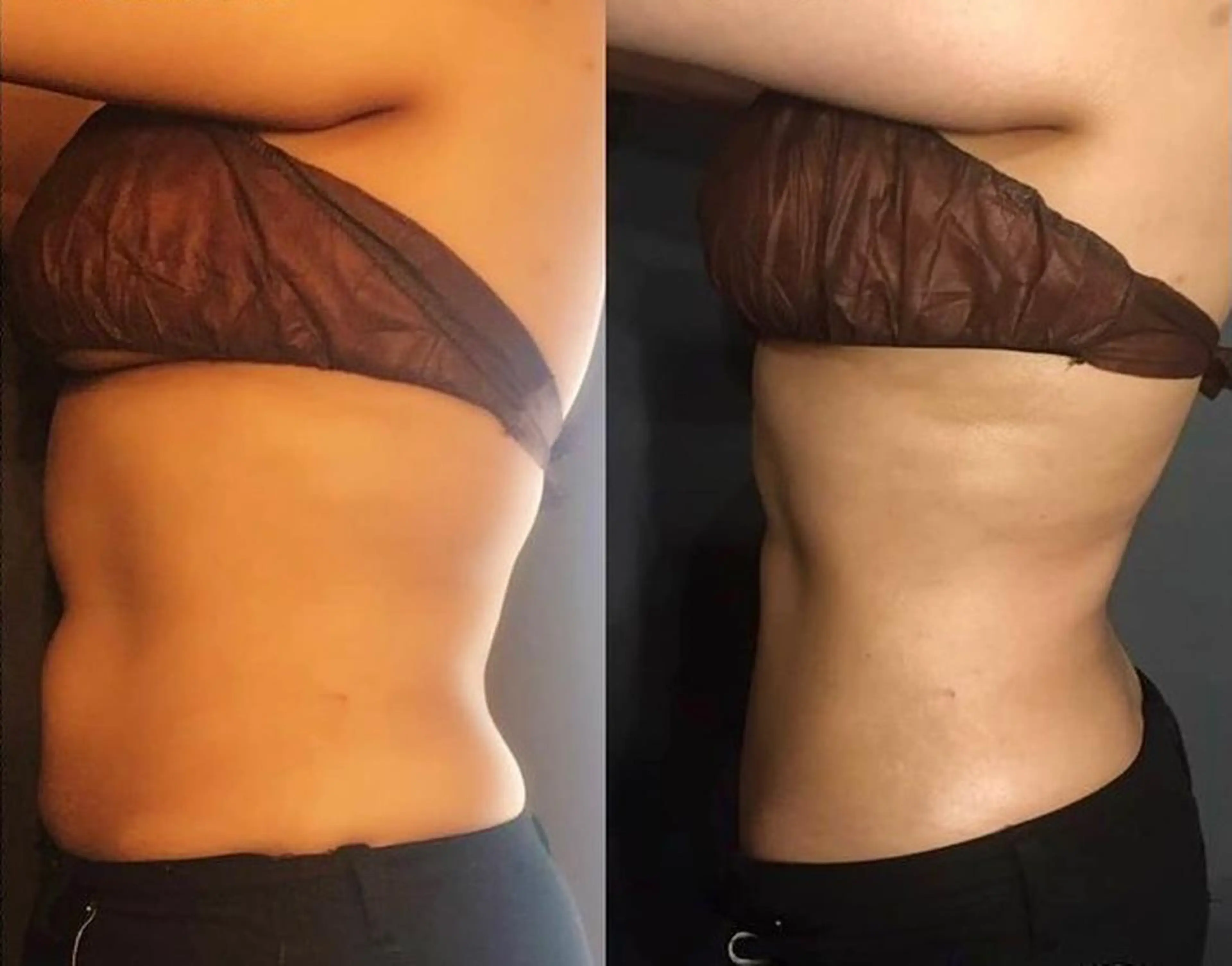 【小顔】【痩身】人気No.1大満足コース🏅 オーダーメイド90分💖時間内に選べる施術で満足度🆙の写真