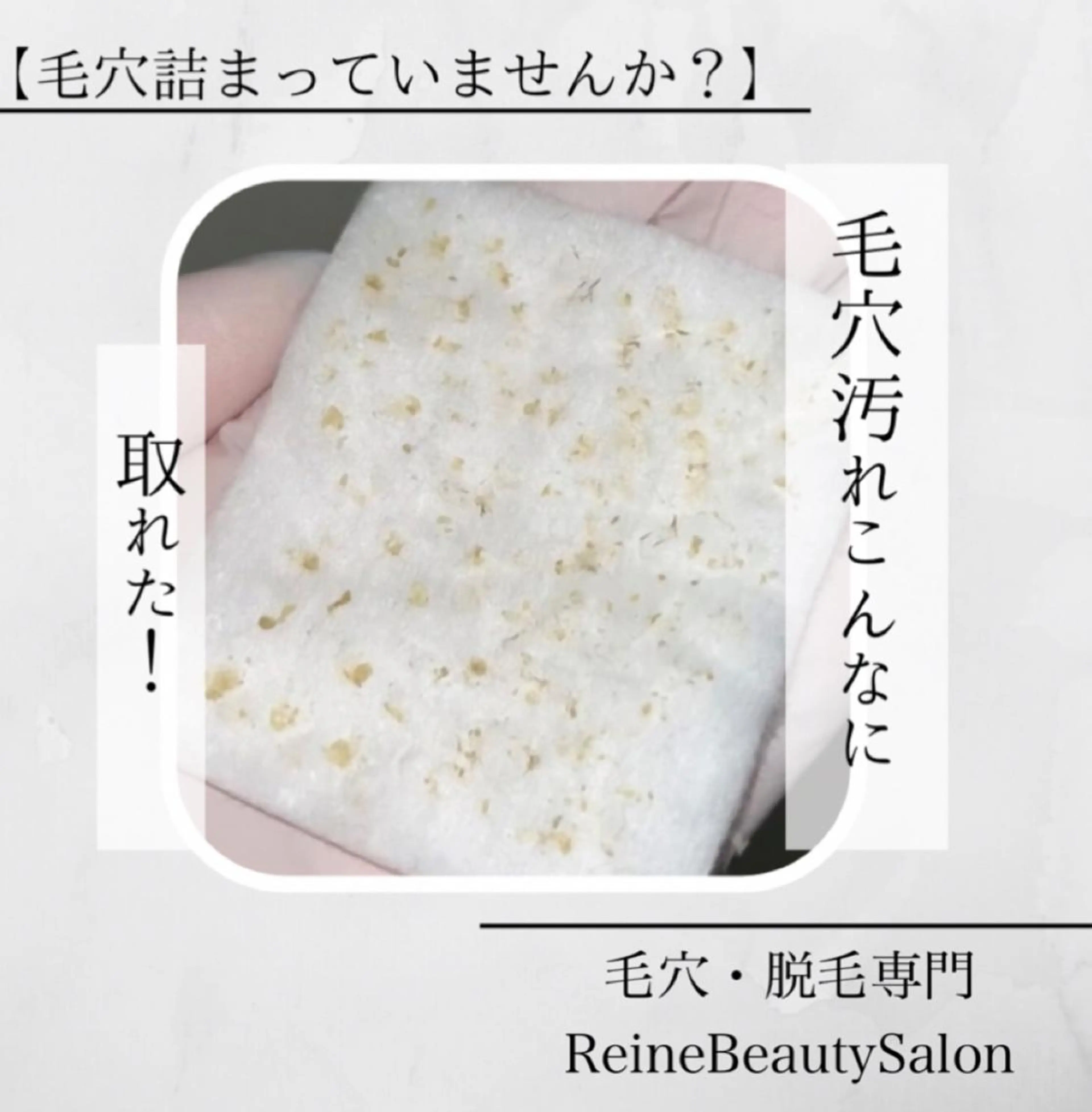 エステ Reine BeautySalon所属・毛穴/シミ肝斑/脱毛 横山梨里のエステ・リラクイメージ