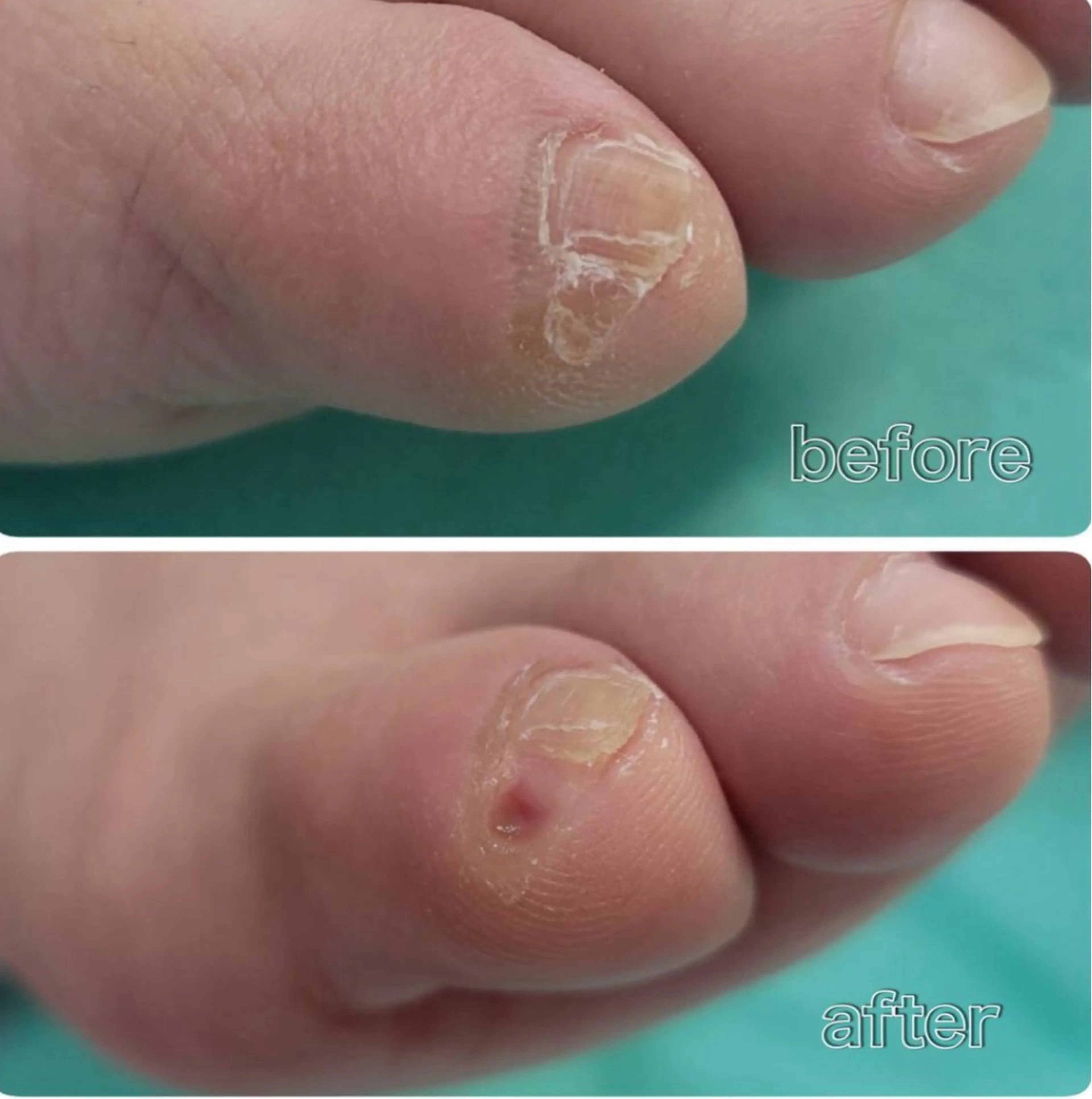 リラク 福岡巻き爪補正店 博多店のエステ・リラクイメージ