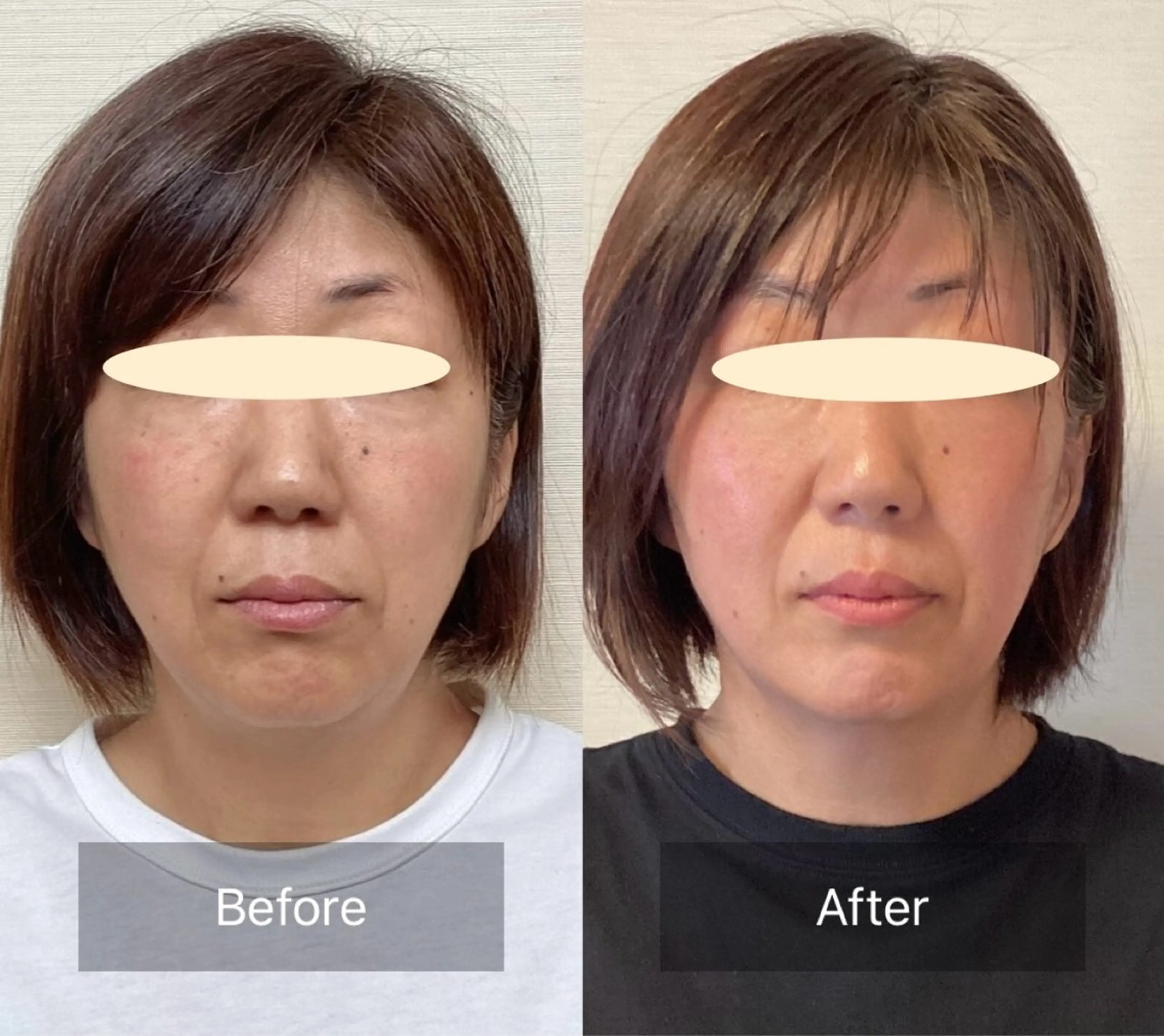 エステ リラク ルコナビューティ所属・小顔・歪み専門　井元 朋子のエステ・リラクイメージ