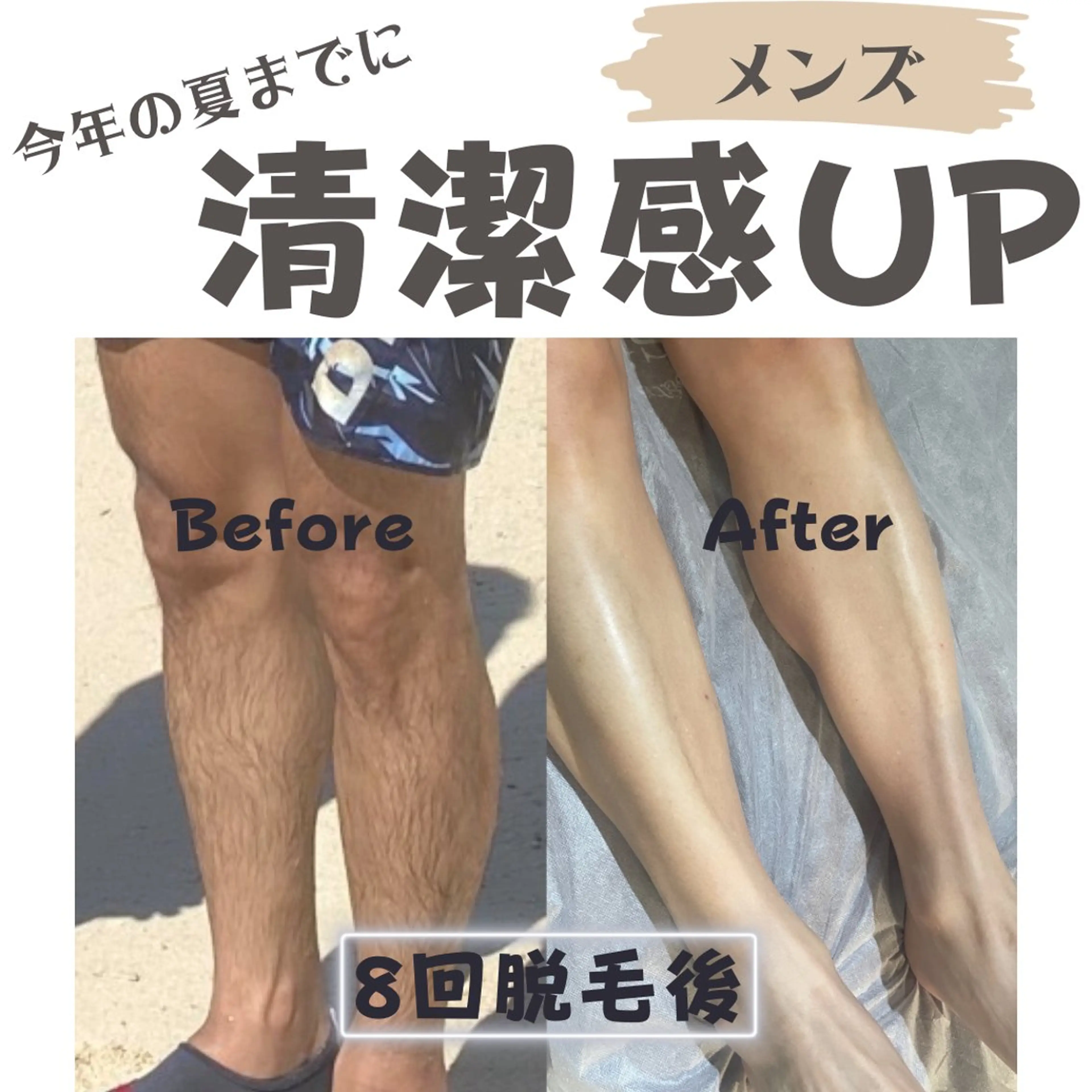 メンズ キッズ 脱毛サロン@M.Room by galbe所属・松や Roomのエステ・リラクイメージ