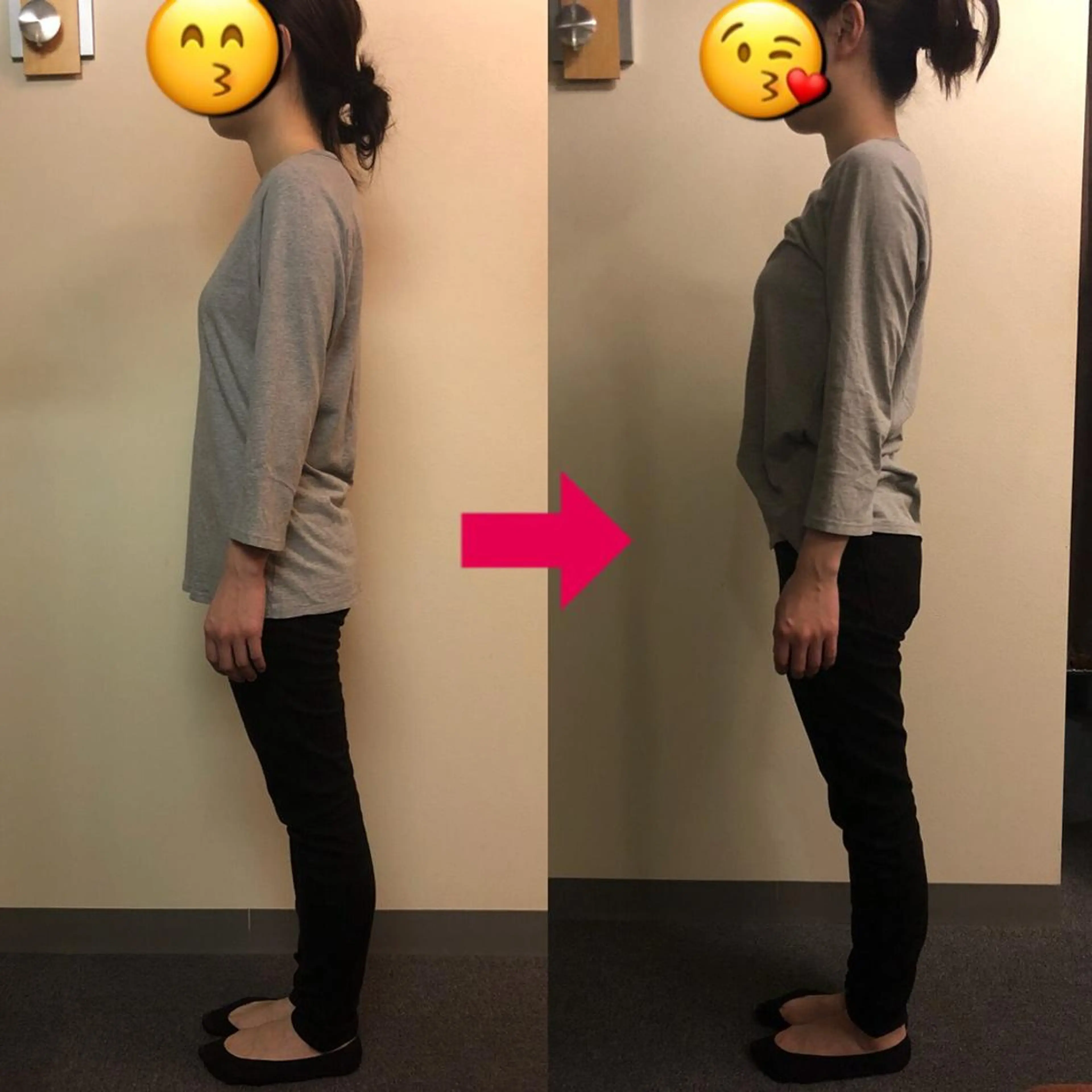 姿勢スタイル美人コース(姿勢、骨盤、O脚X脚 矯正あり)の写真