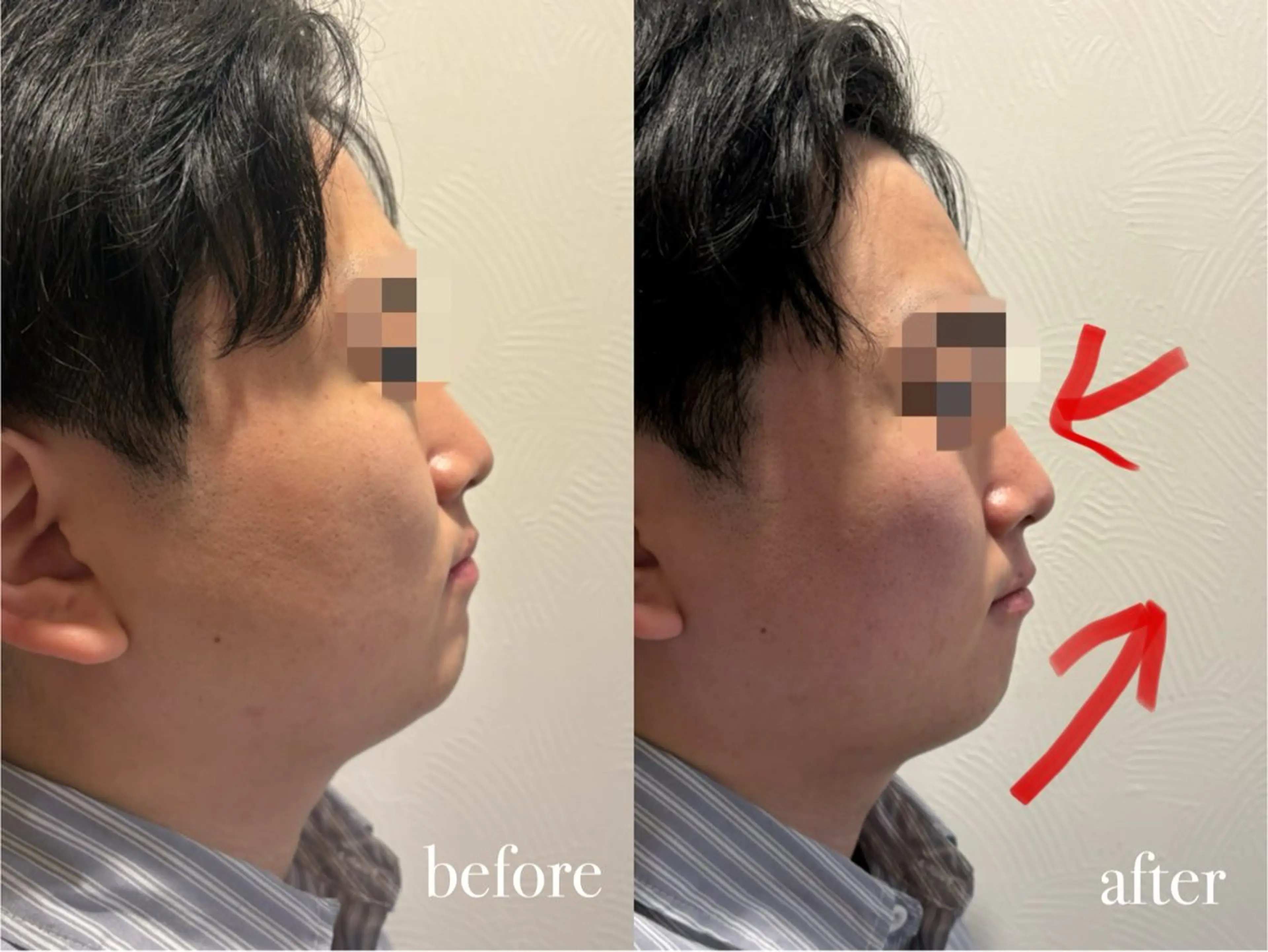 【本日限定価格‼️】小顔整体45分¥3300✅💯の写真