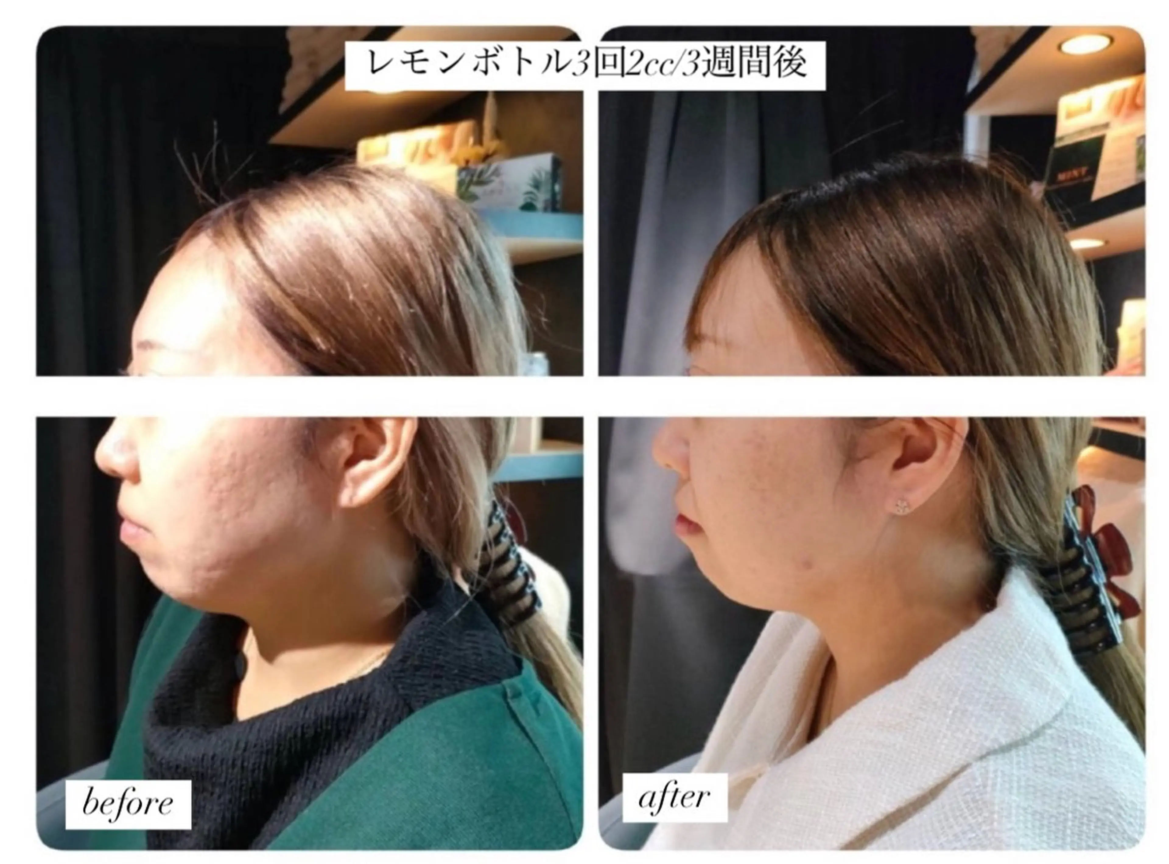 beautysalon  DiAViM所属・本格コルギ美肌美眉 DiAViM 💎のエステ・リラクイメージ