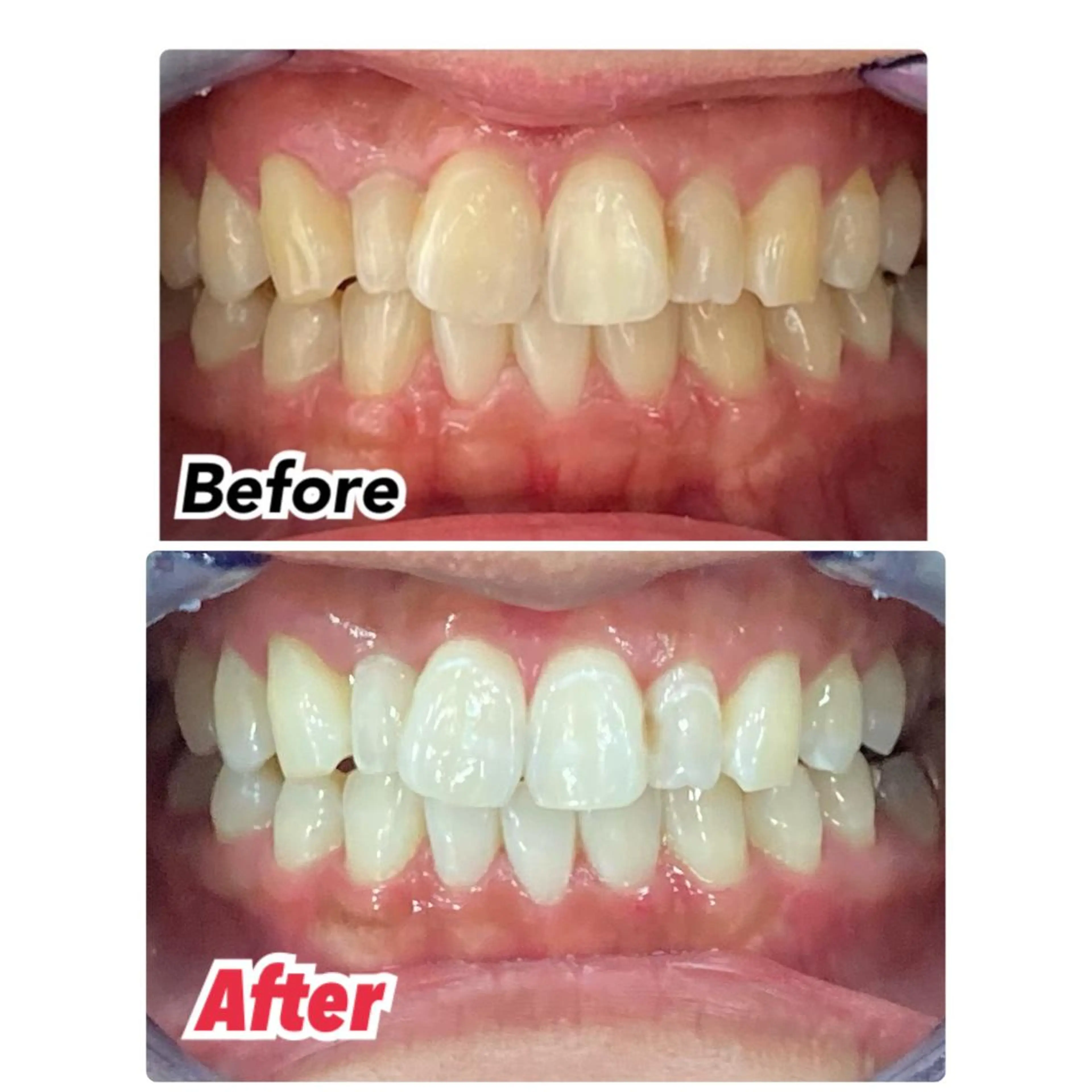 ロング メンズ キッズ ネイル マツエク・マツパ アイブロウ プラチナムビューティー柏所属・【歯科提携】柏ホワイ トニングスタイルのその他イメージ