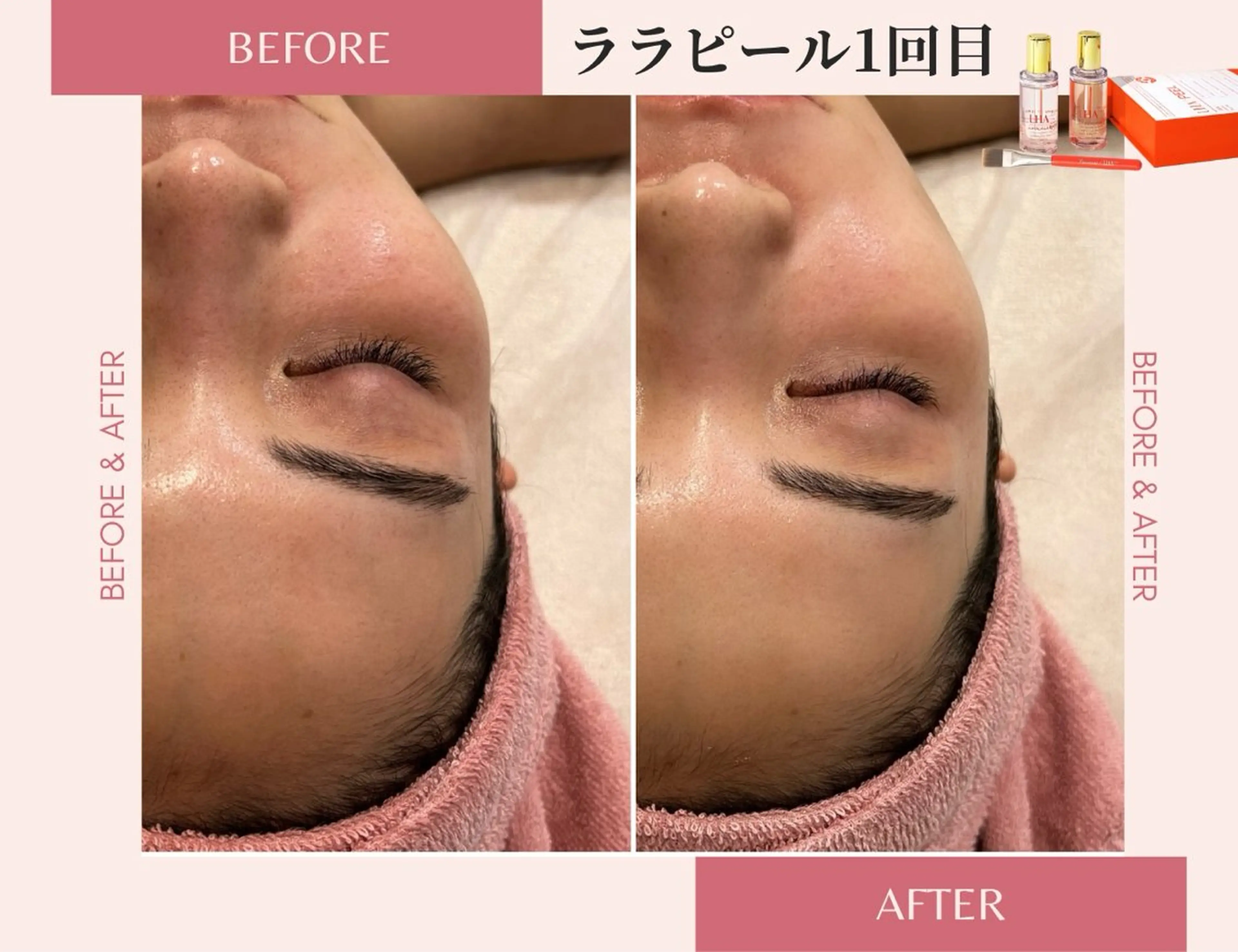 医療提携サロン&パーソナルカラー/骨格/顔タイプ診断 La chic所属・パーソナルカラー ＆エステ SHIHOのその他イメージ