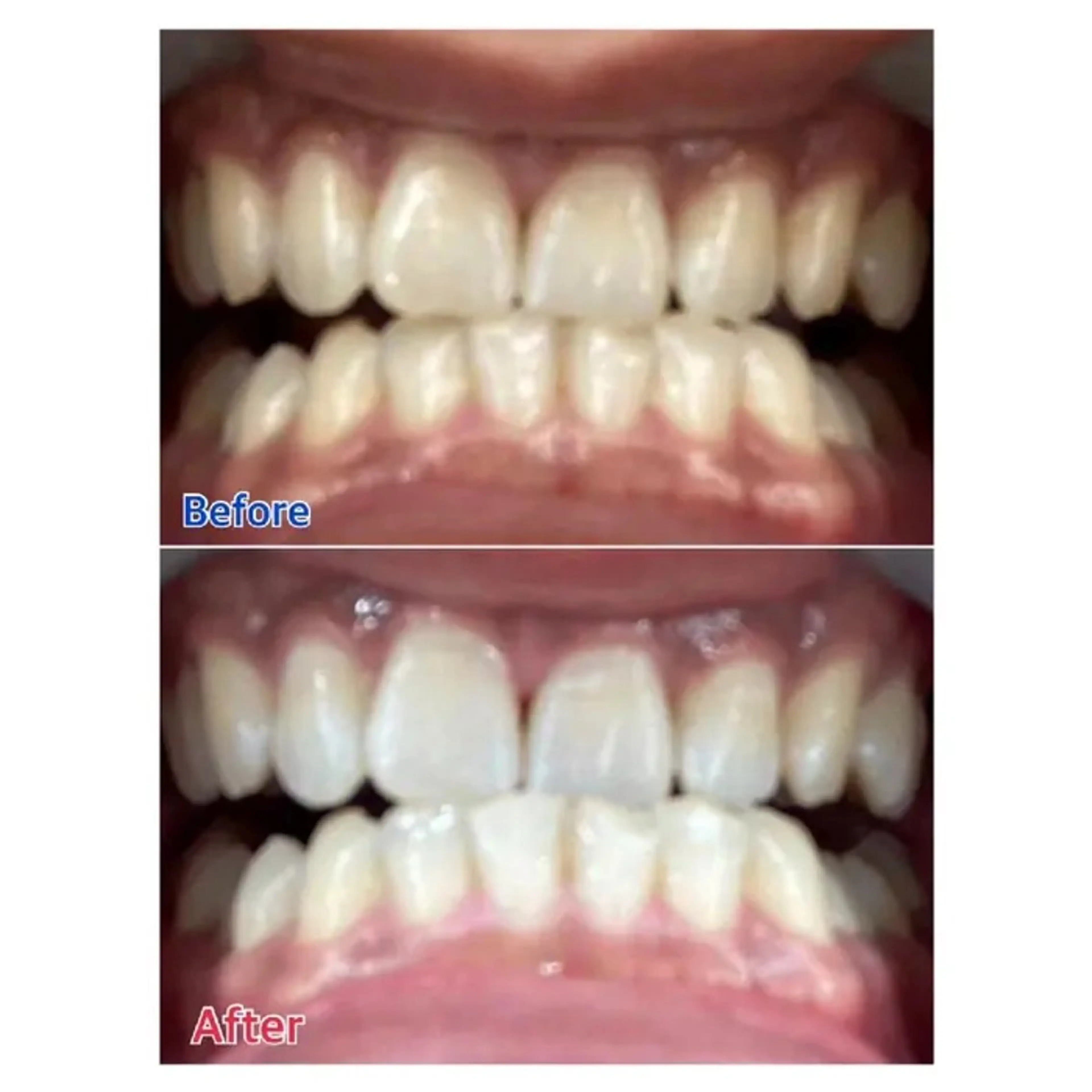 M渋谷店所属・M渋谷 ホワイトニングのエステ・リラクイメージ